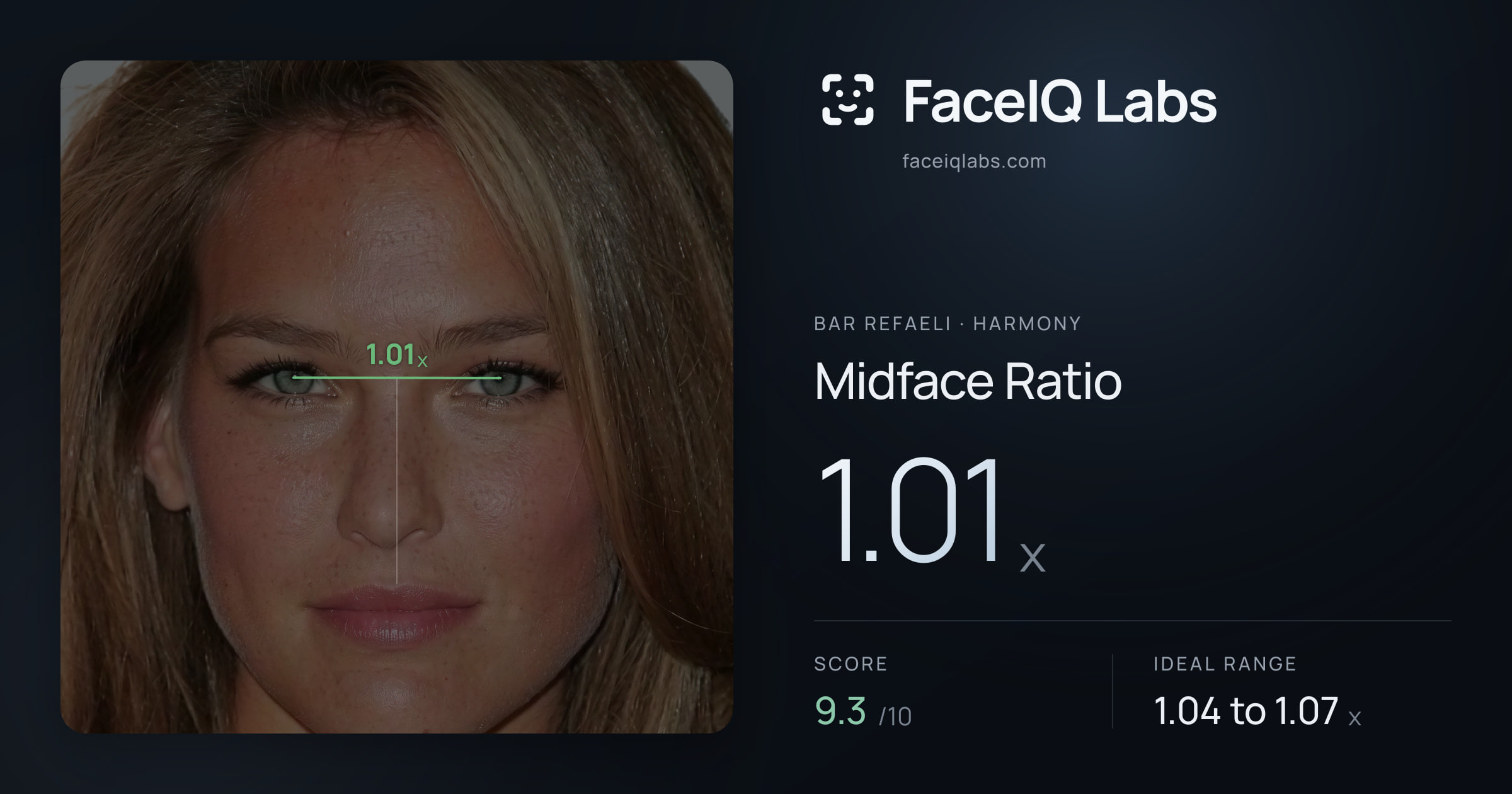 Bar Refaeli Midface Ratio: 1.01x, drawn on the photo