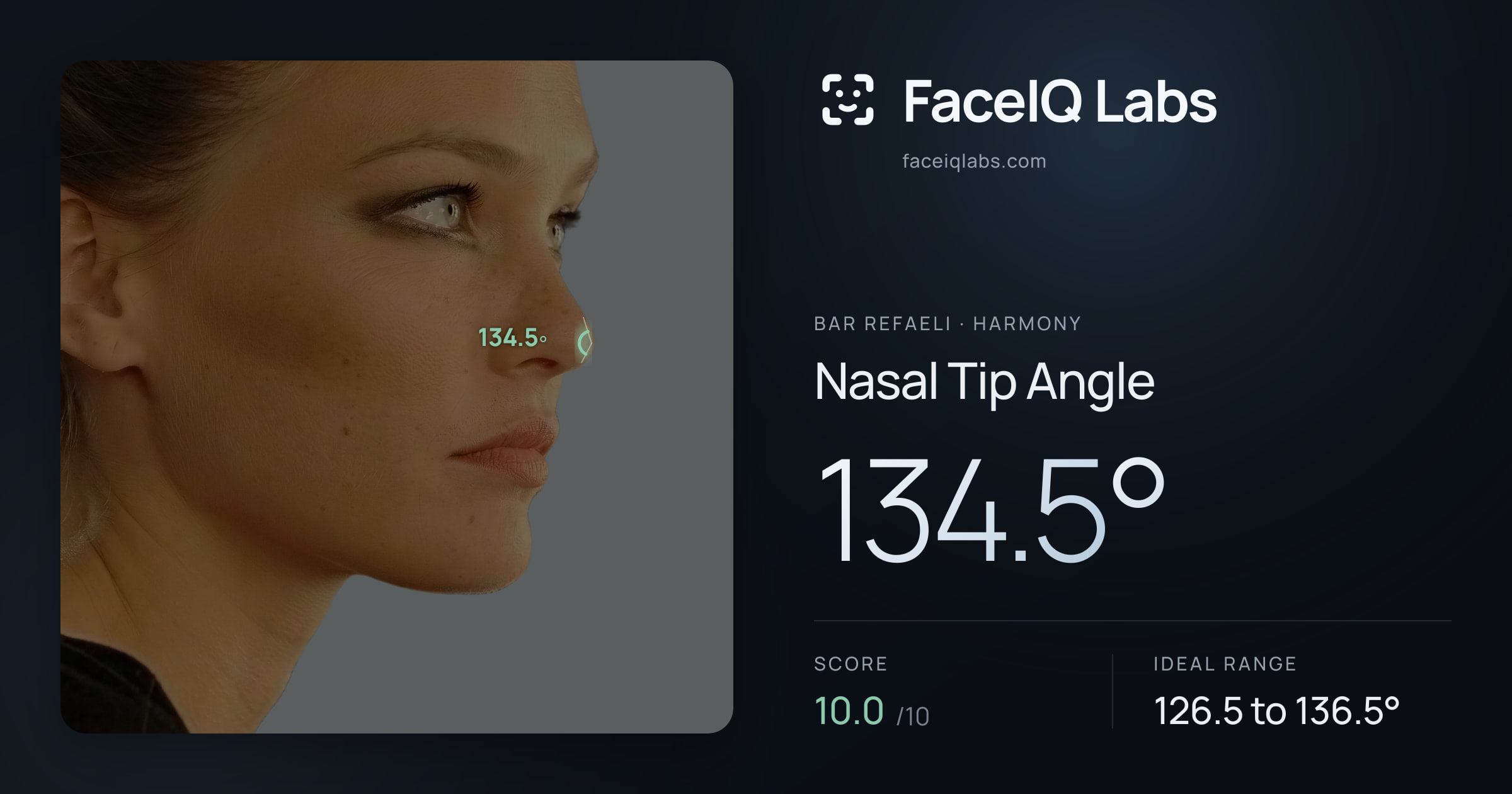 Bar Refaeli Nasal Tip Angle: 134.5°, drawn on the photo