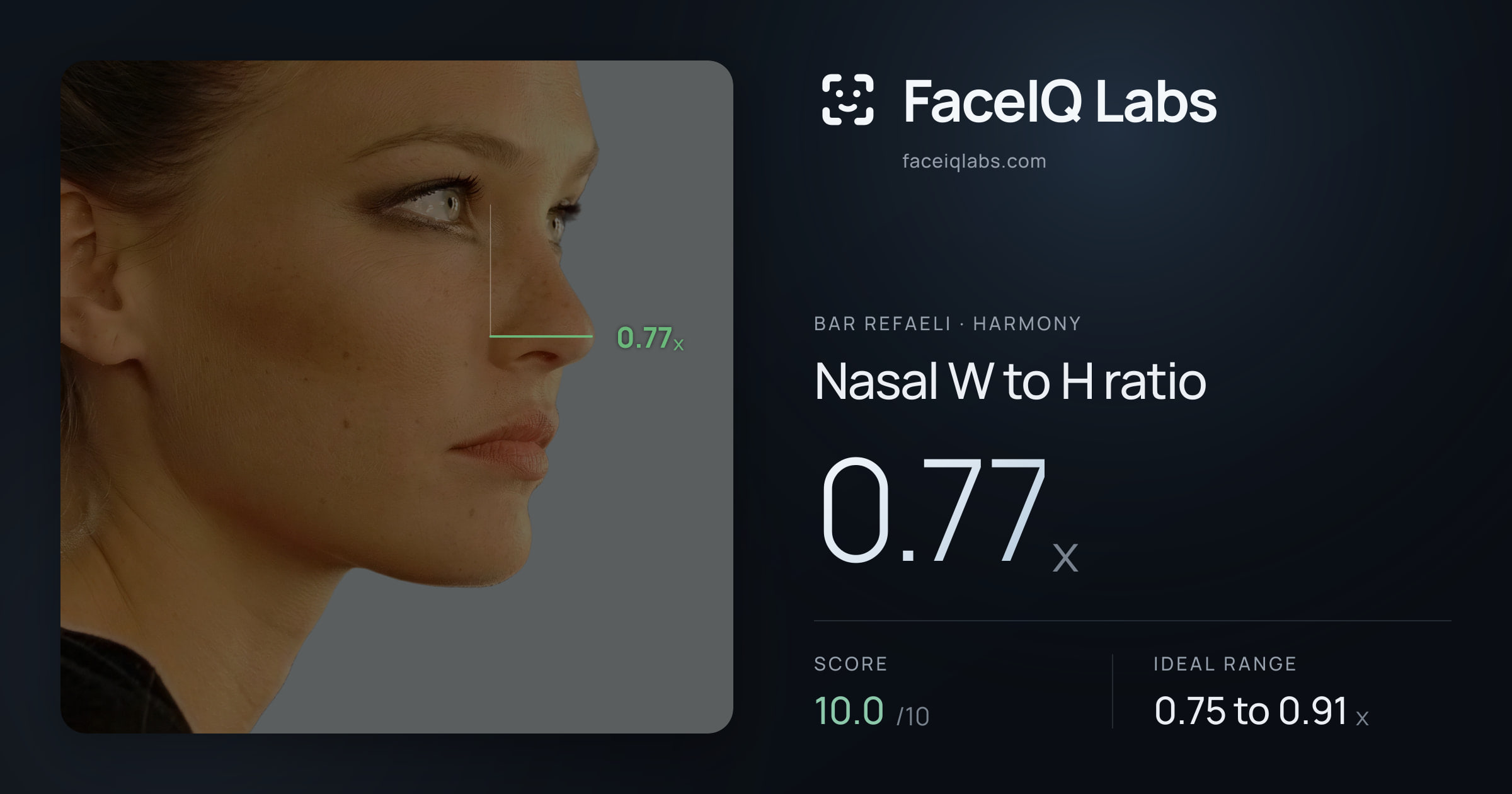 Bar Refaeli Nasal W to H ratio: 0.77x, drawn on the photo