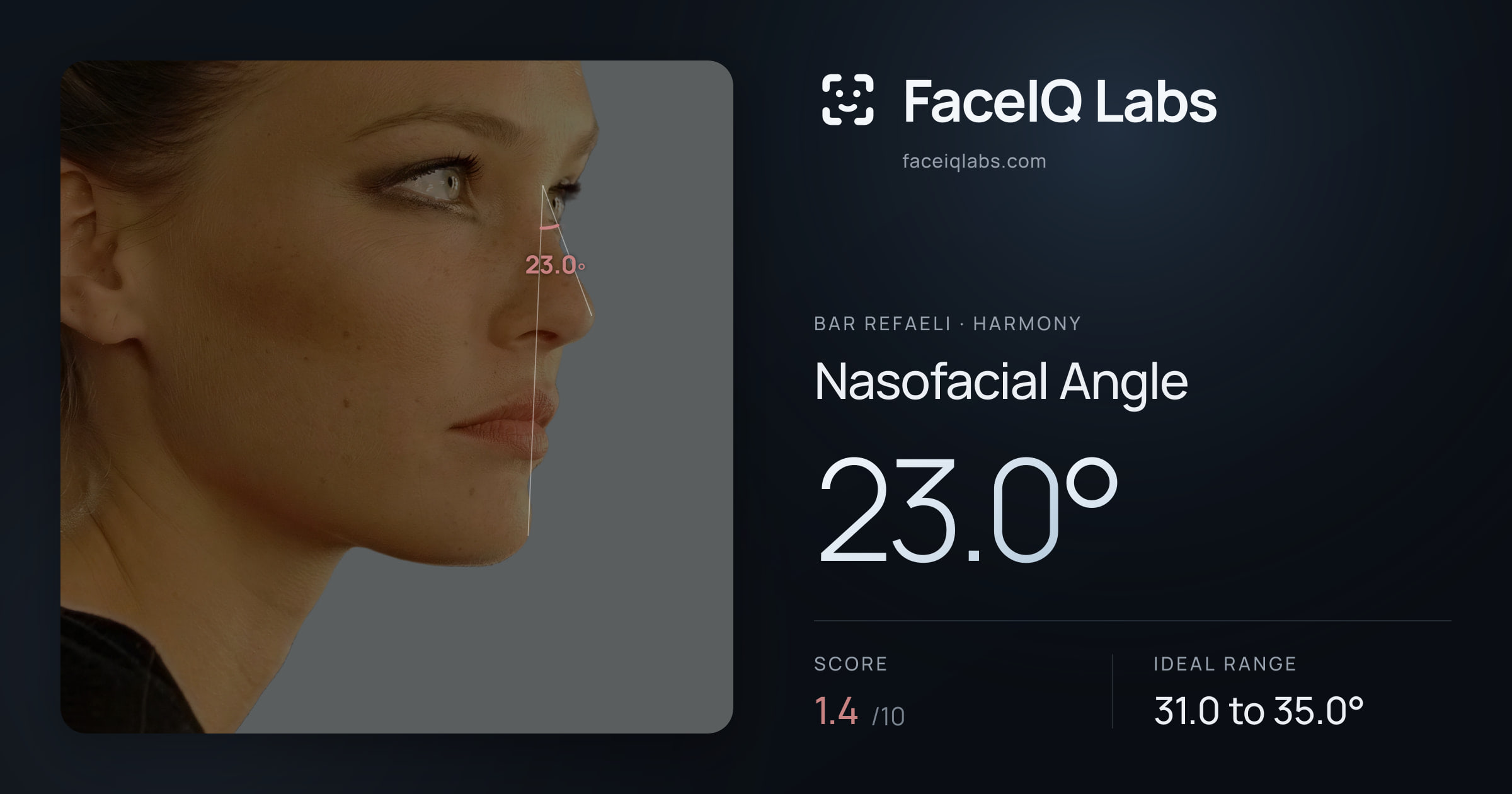 Bar Refaeli Nasofacial Angle: 23.0°, drawn on the photo