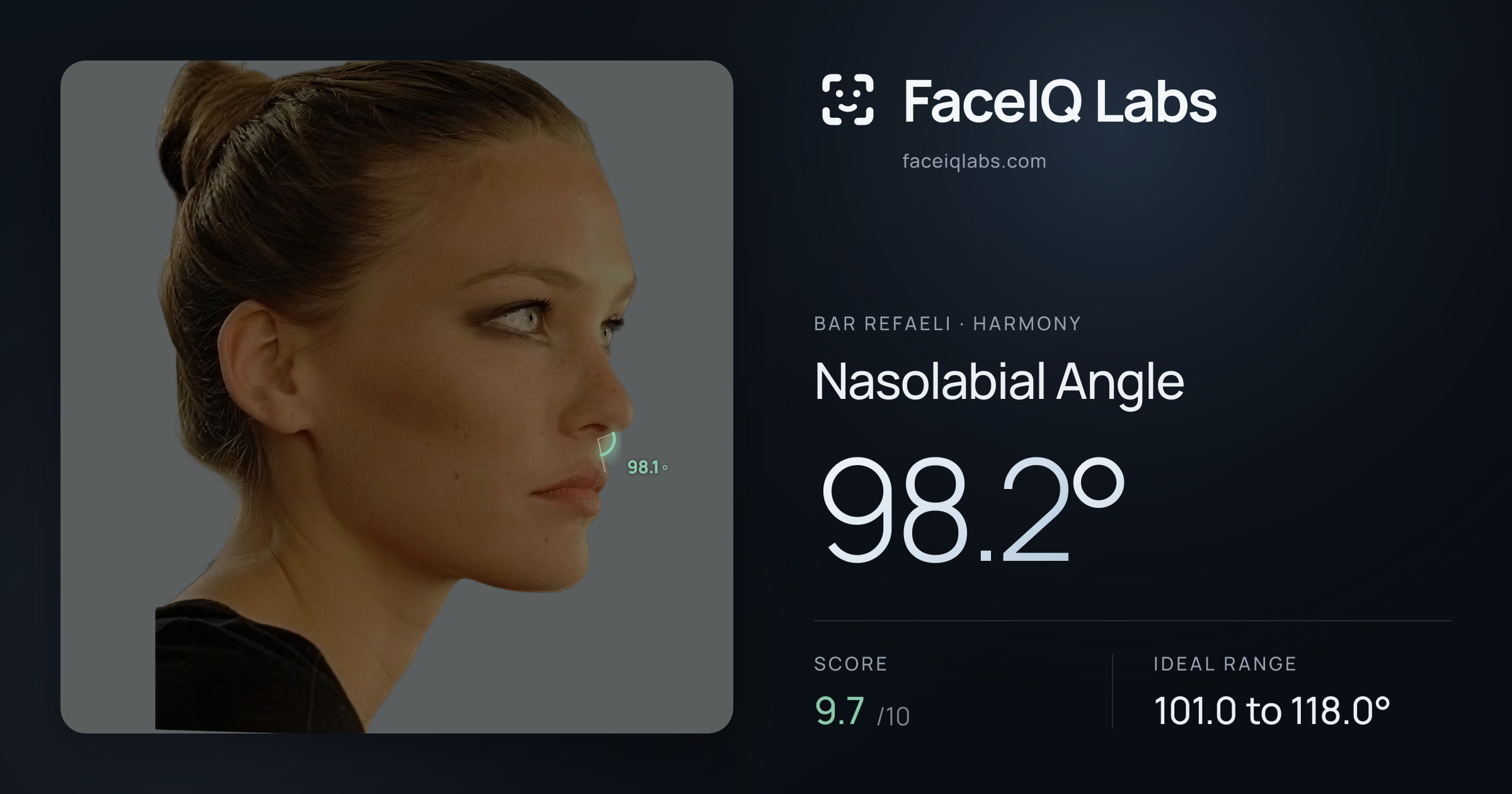 Bar Refaeli Nasolabial Angle: 98.2°, drawn on the photo