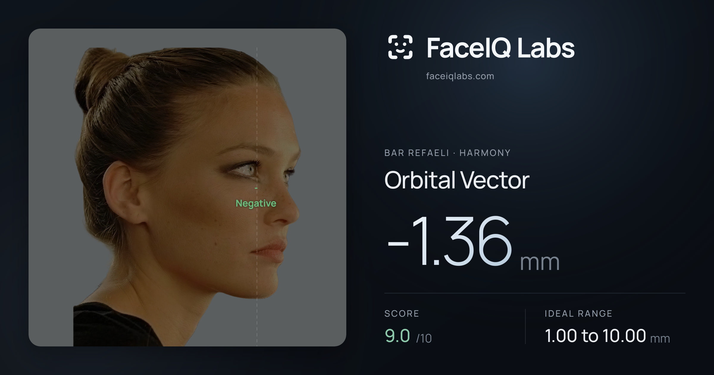 Bar Refaeli Orbital Vector: -1.36mm, drawn on the photo