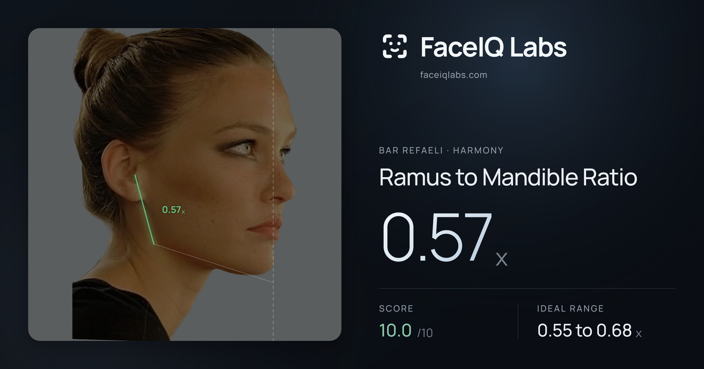 Bar Refaeli Ramus to Mandible Ratio: 0.57x, drawn on the photo