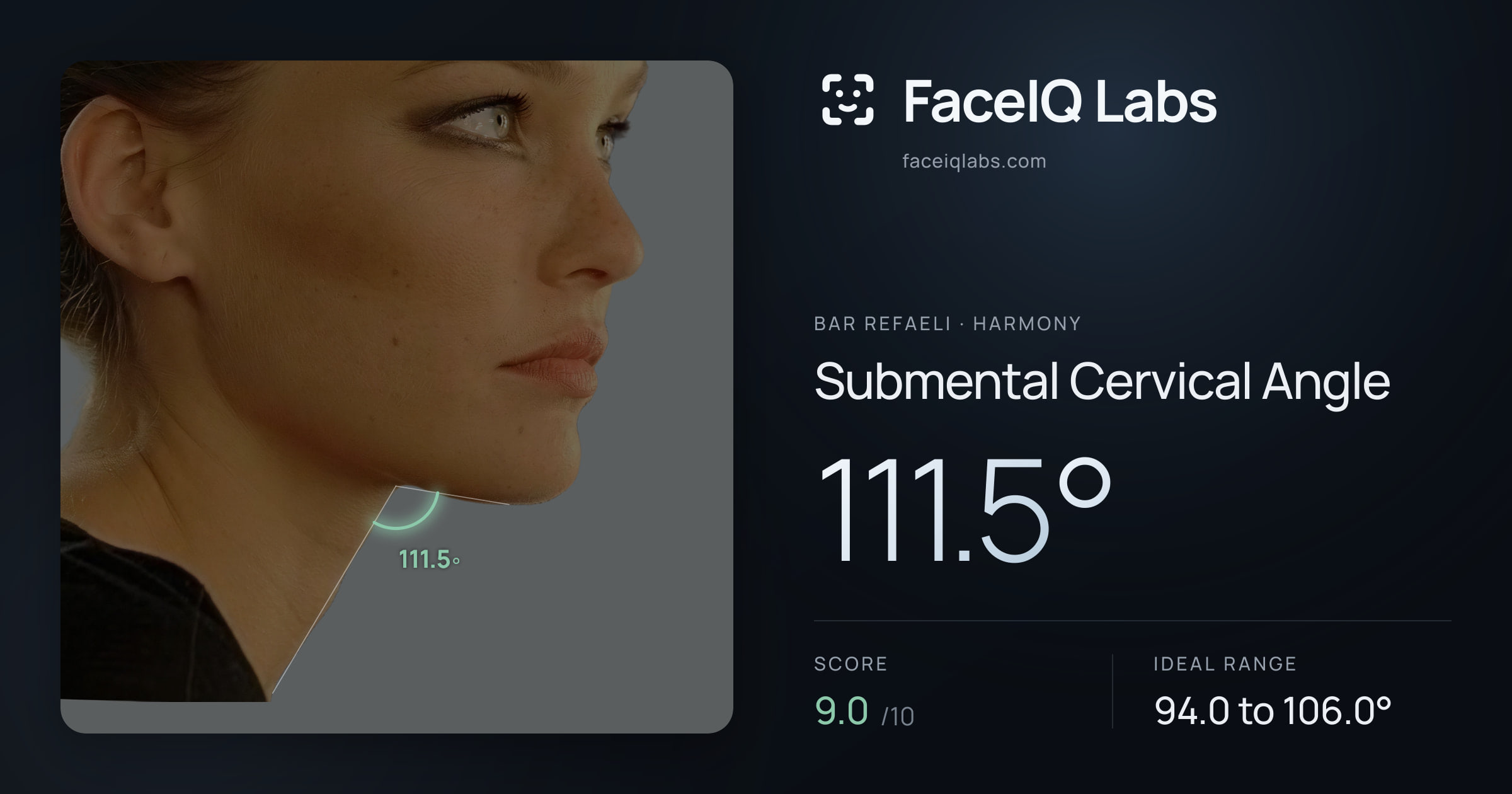 Bar Refaeli Submental Cervical Angle: 111.5°, drawn on the photo