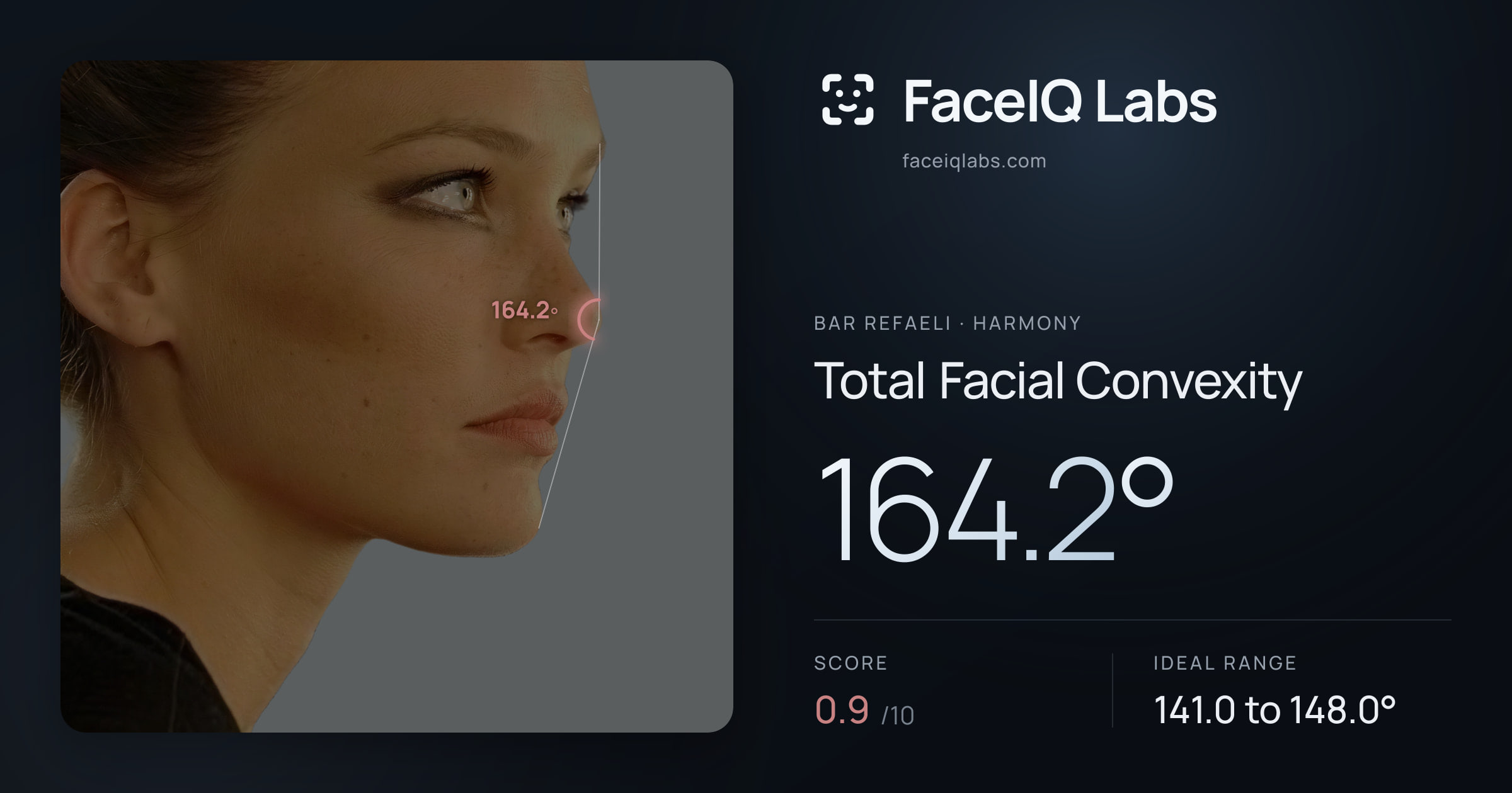 Bar Refaeli Total Facial Convexity: 164.2°, drawn on the photo
