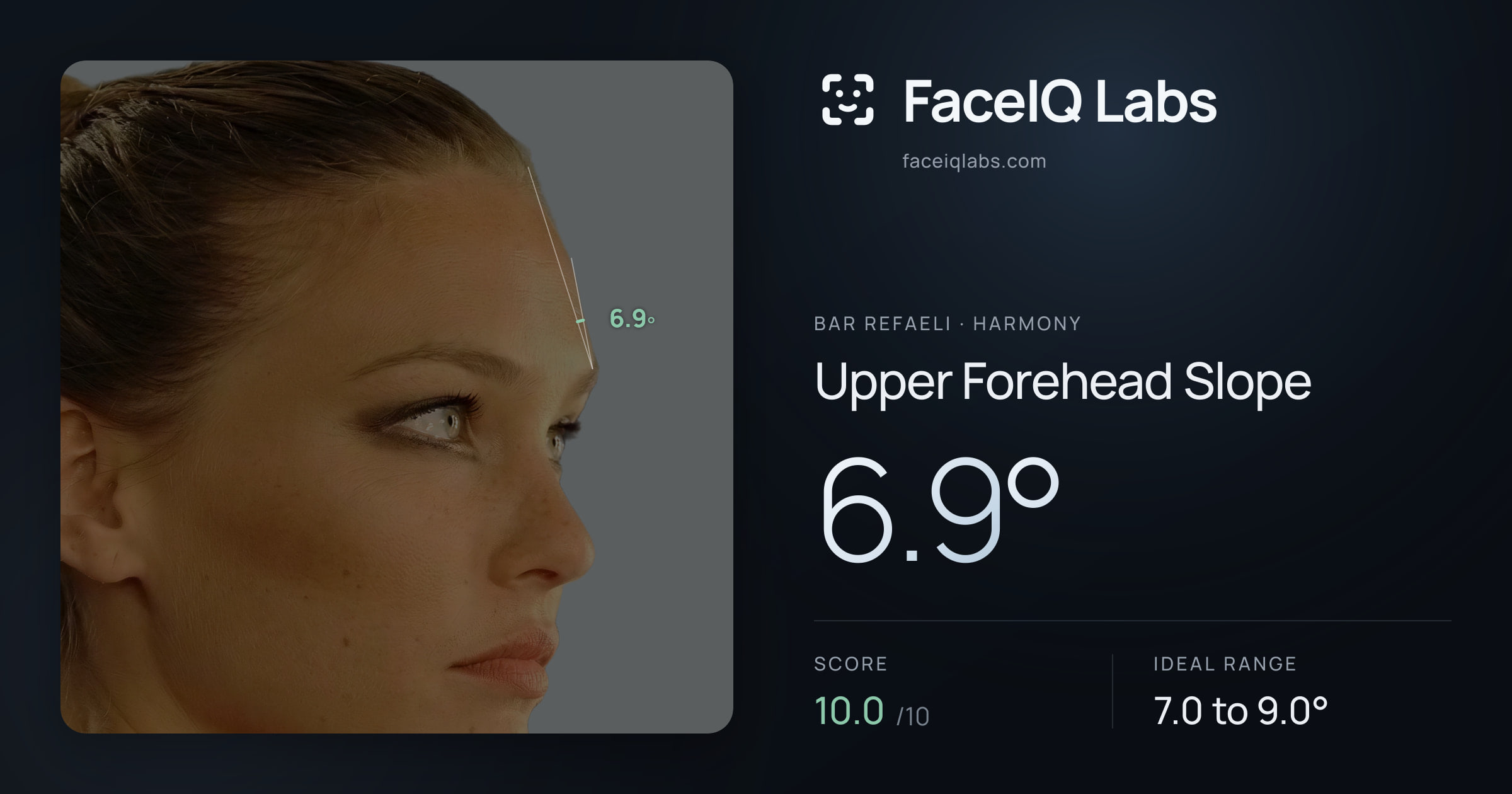 Bar Refaeli Upper Forehead Slope: 6.9°, drawn on the photo