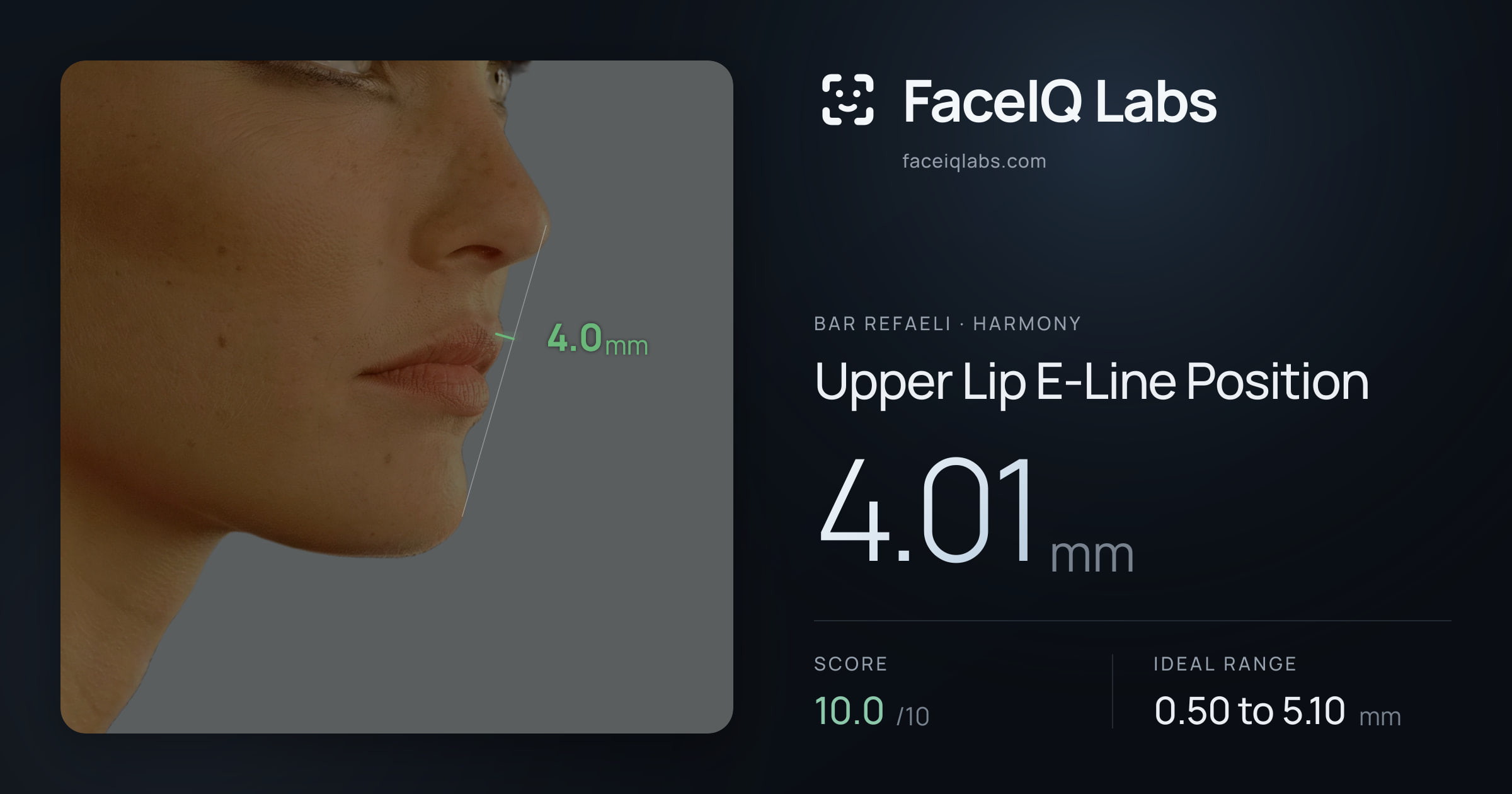 Bar Refaeli Upper Lip E-Line Position: 4.01mm, drawn on the photo