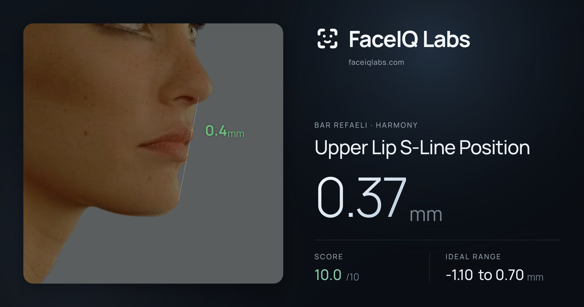 Bar Refaeli Upper Lip S-Line Position: 0.37mm, drawn on the photo