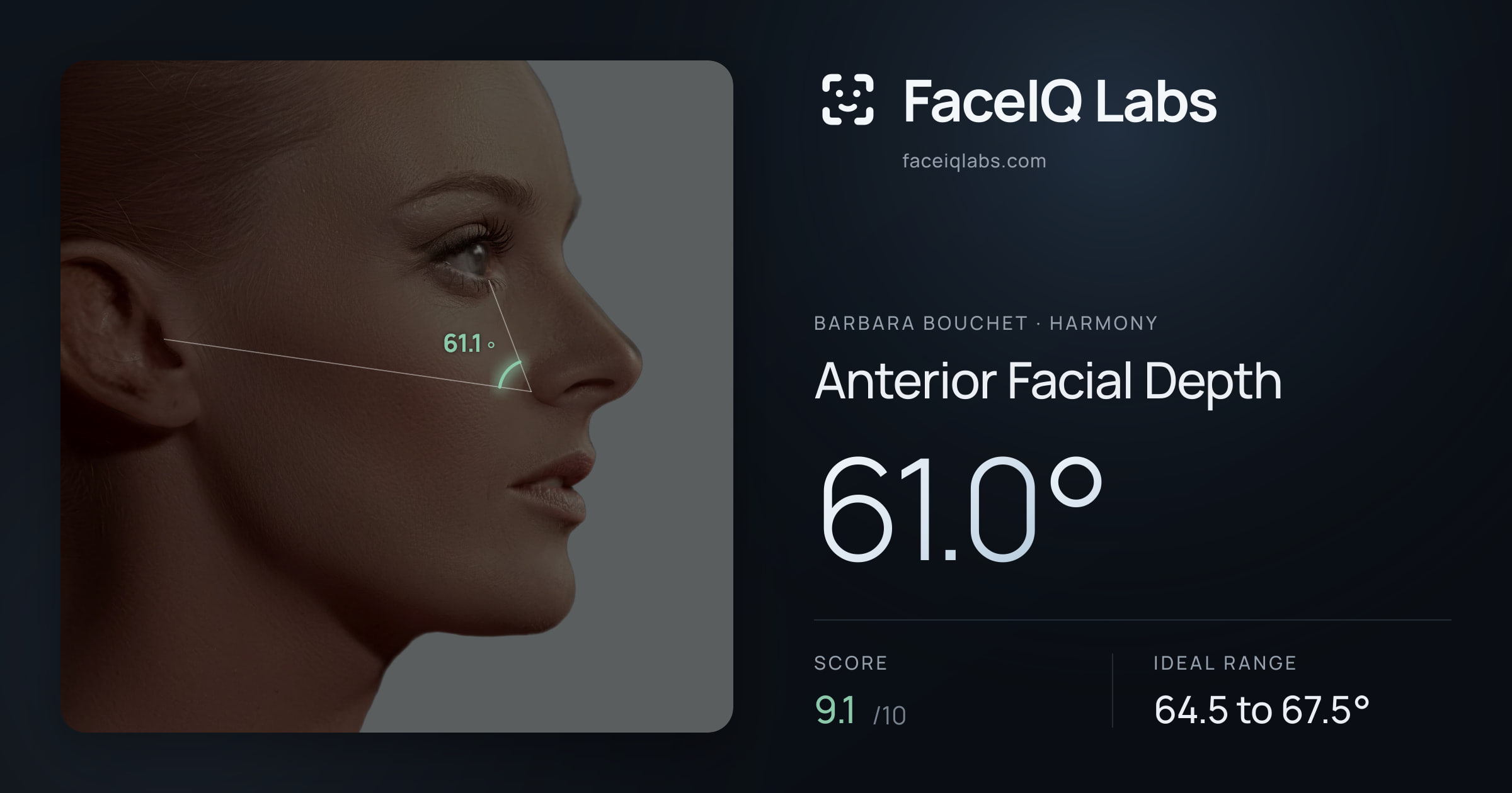 Barbara Bouchet Anterior Facial Depth: 61.0°, drawn on the photo