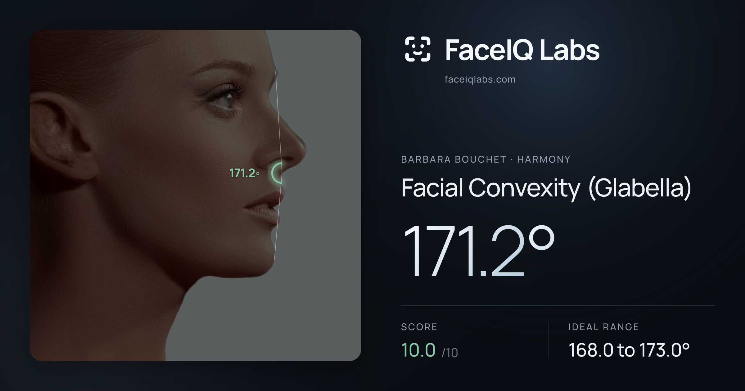 Barbara Bouchet Facial Convexity (Glabella): 171.2°, drawn on the photo