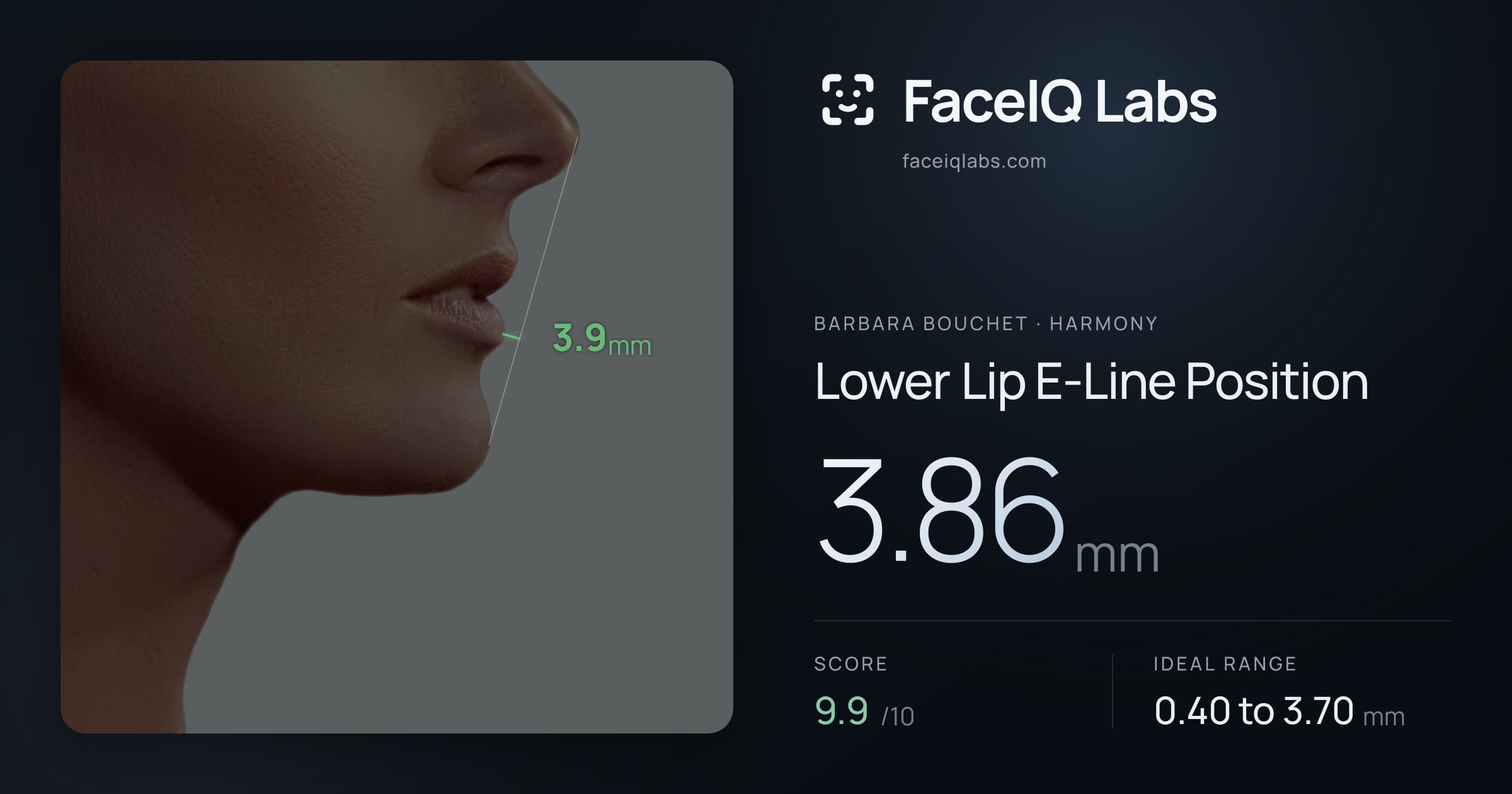 Barbara Bouchet Lower Lip E-Line Position: 3.86mm, drawn on the photo