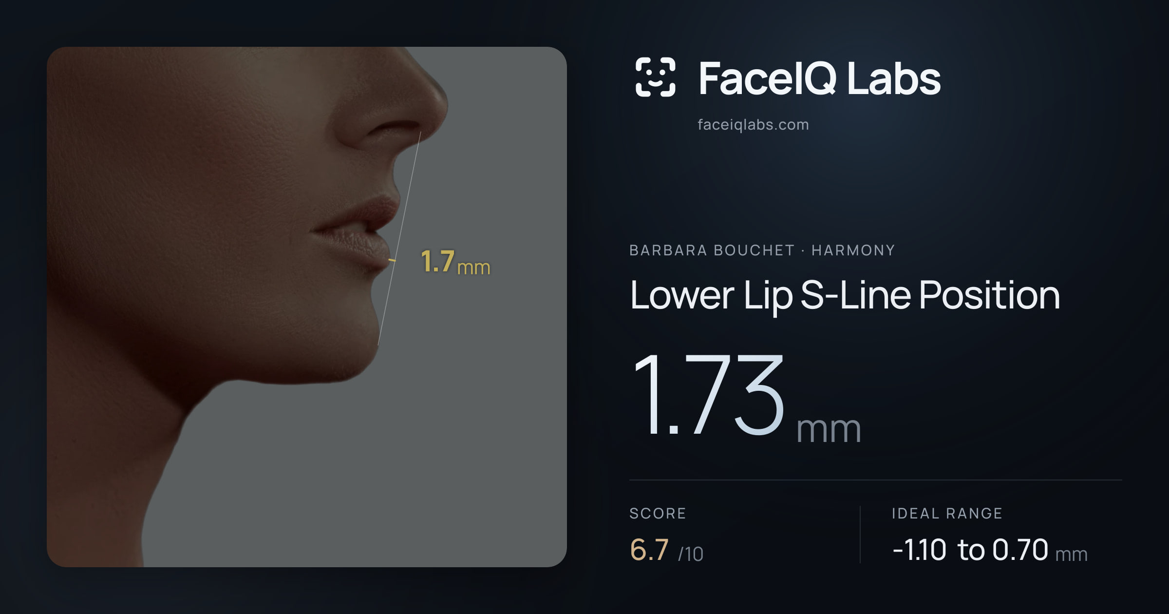 Barbara Bouchet Lower Lip S-Line Position: 1.73mm, drawn on the photo