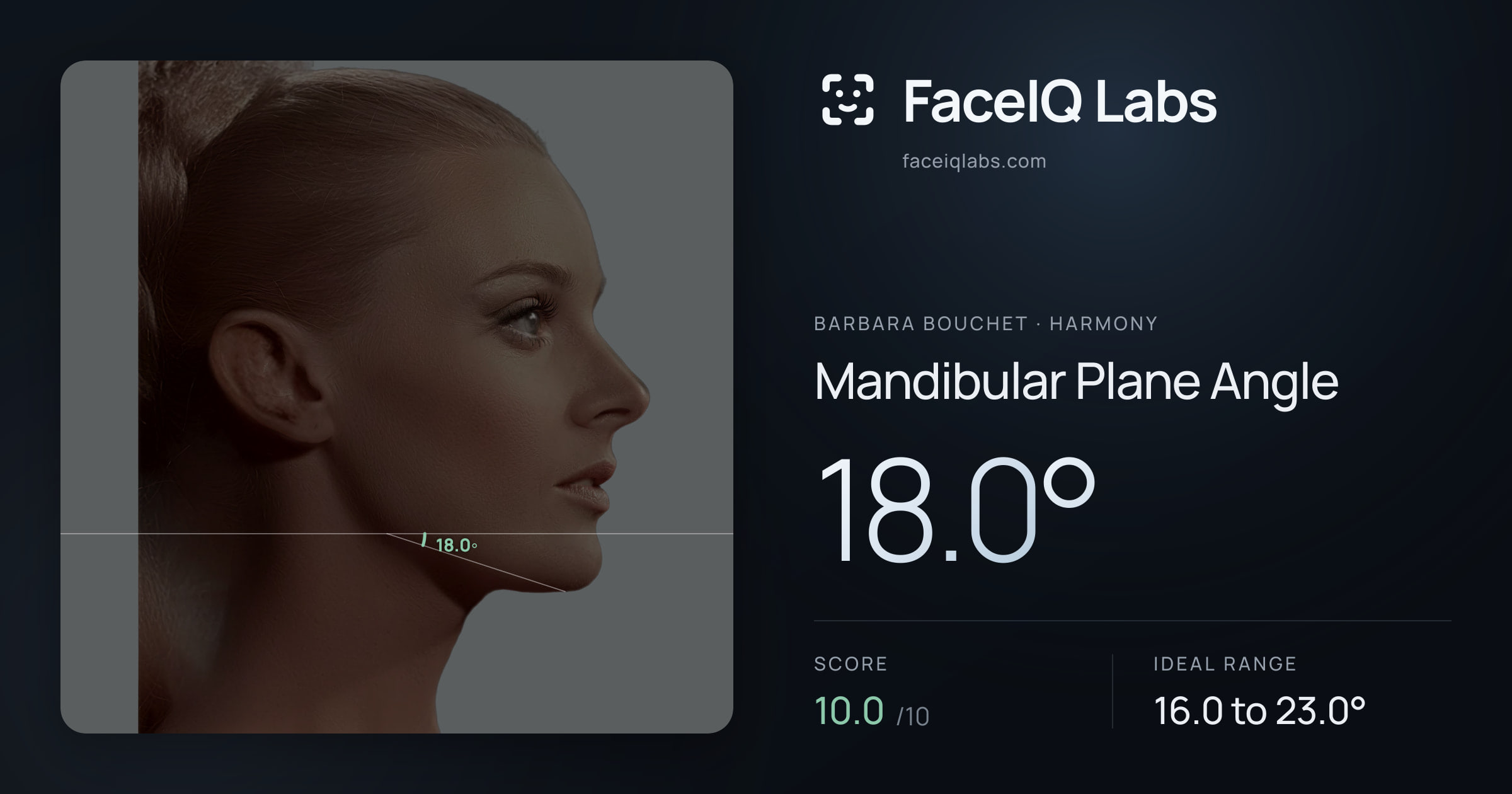 Barbara Bouchet Mandibular Plane Angle: 18.0°, drawn on the photo
