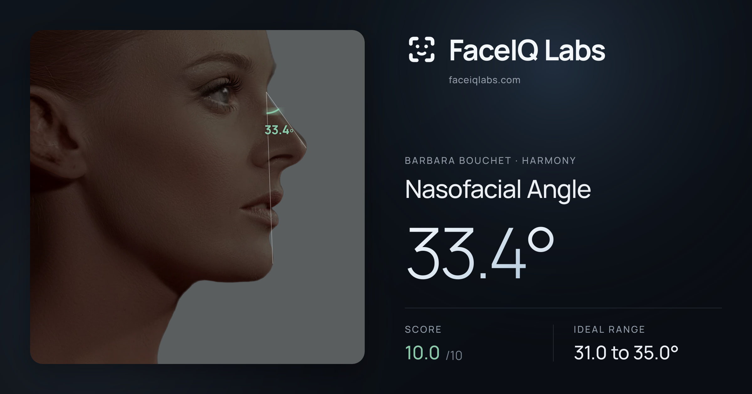 Barbara Bouchet Nasofacial Angle: 33.4°, drawn on the photo