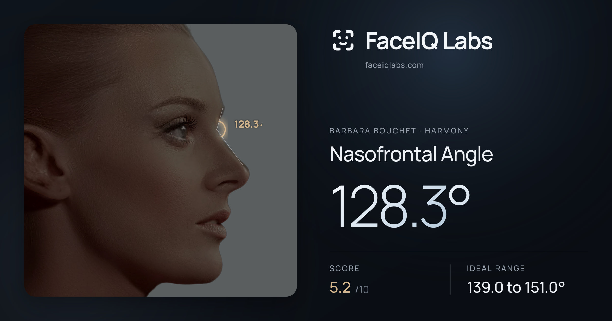 Barbara Bouchet Nasofrontal Angle: 128.3°, drawn on the photo
