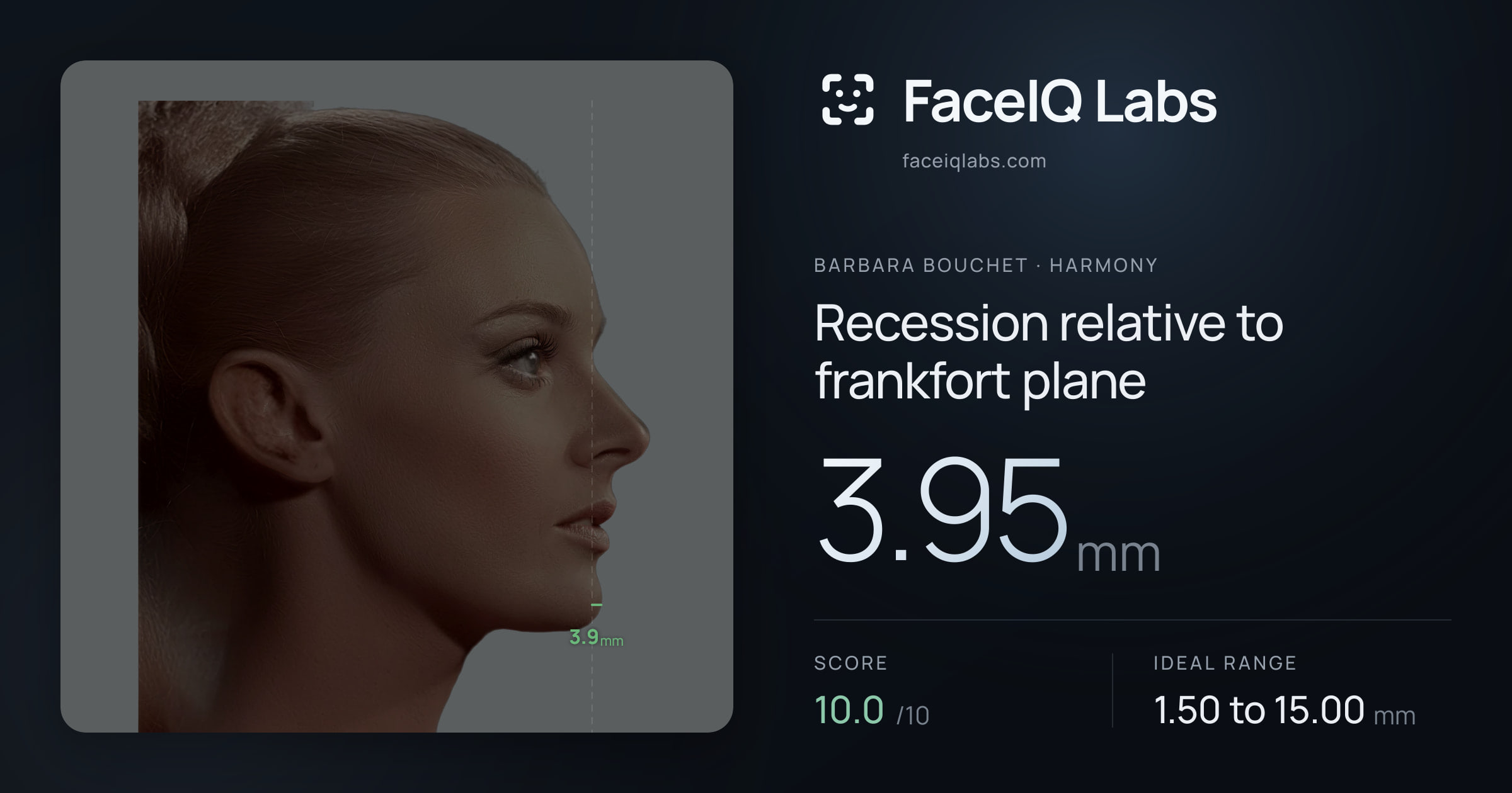 Barbara Bouchet Recession relative to frankfort plane: 3.95mm, drawn on the photo