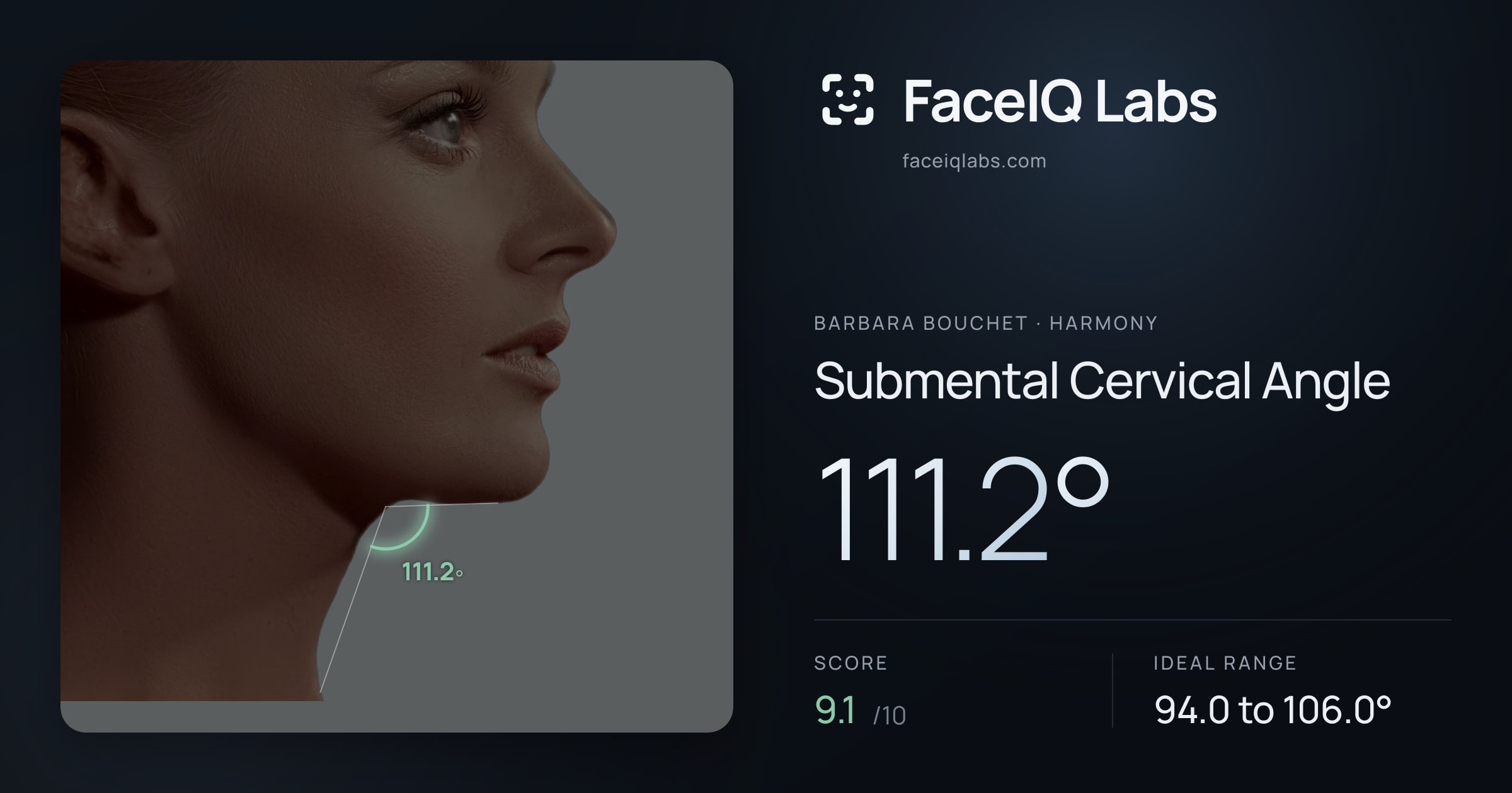 Barbara Bouchet Submental Cervical Angle: 111.2°, drawn on the photo