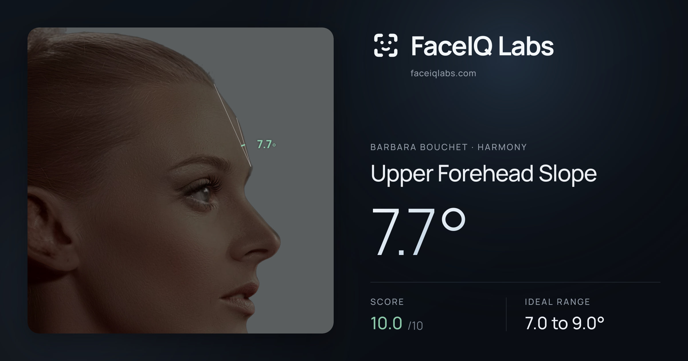 Barbara Bouchet Upper Forehead Slope: 7.7°, drawn on the photo
