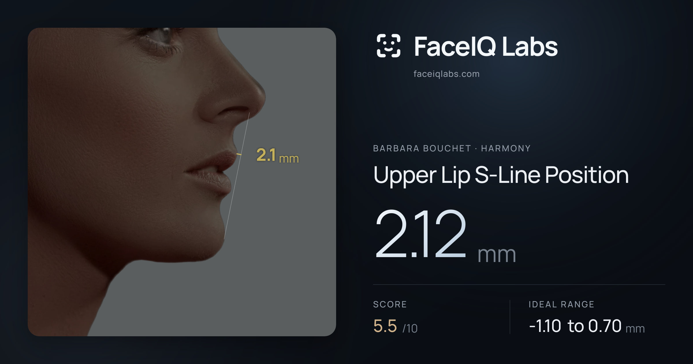 Barbara Bouchet Upper Lip S-Line Position: 2.12mm, drawn on the photo