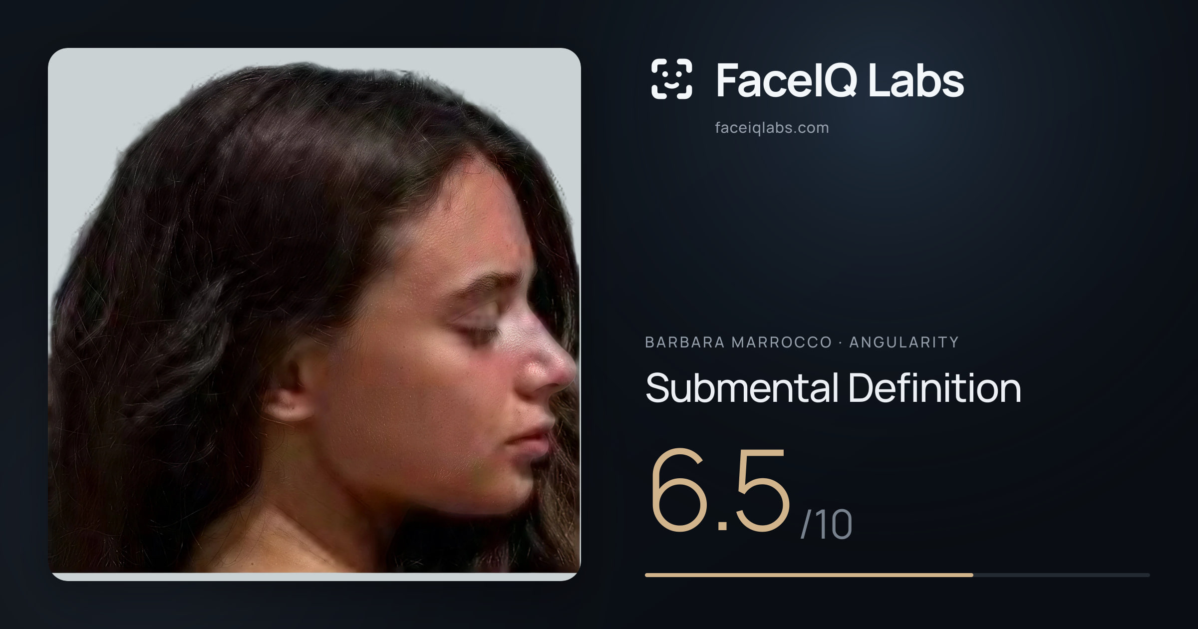 Barbara Marrocco Submental Definition: 6.5/10, drawn on the photo