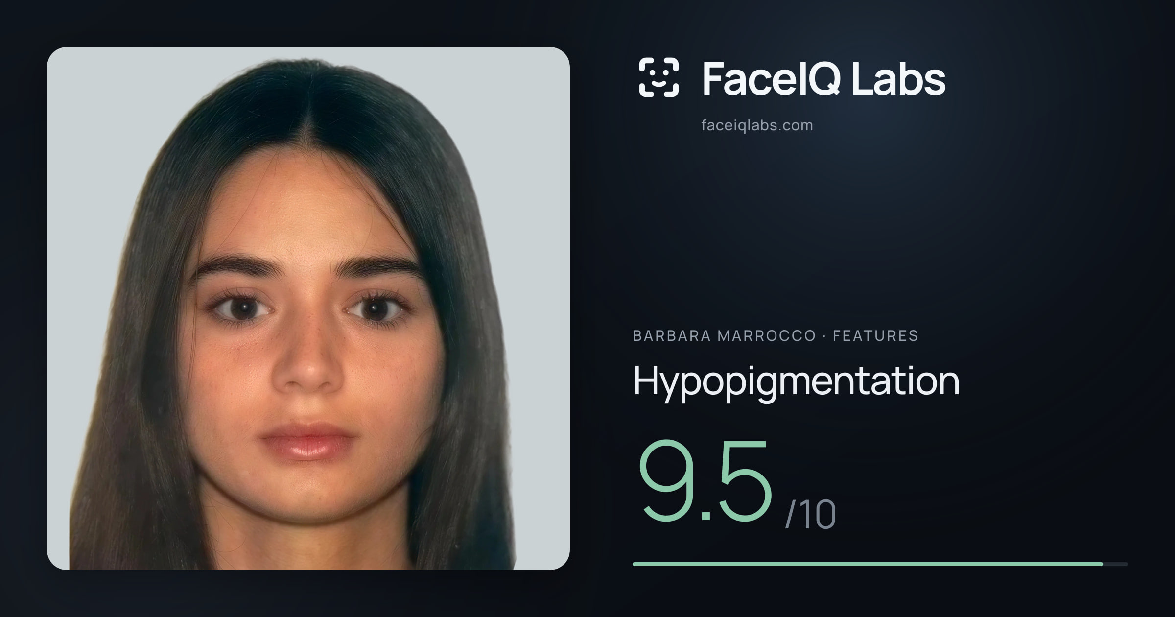 Barbara Marrocco Hypopigmentation: 9.5/10, drawn on the photo