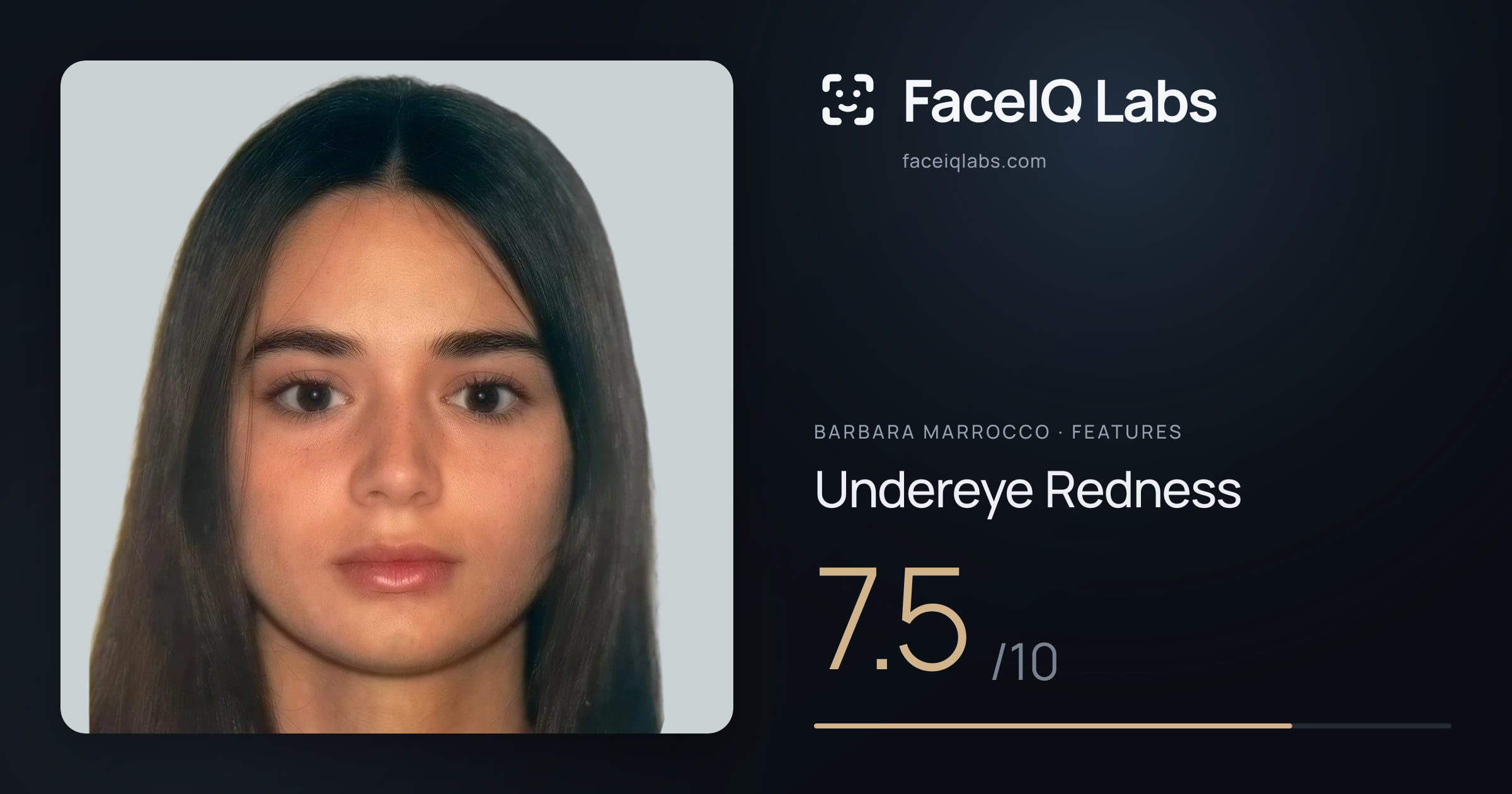 Barbara Marrocco Undereye Redness: 7.5/10, drawn on the photo