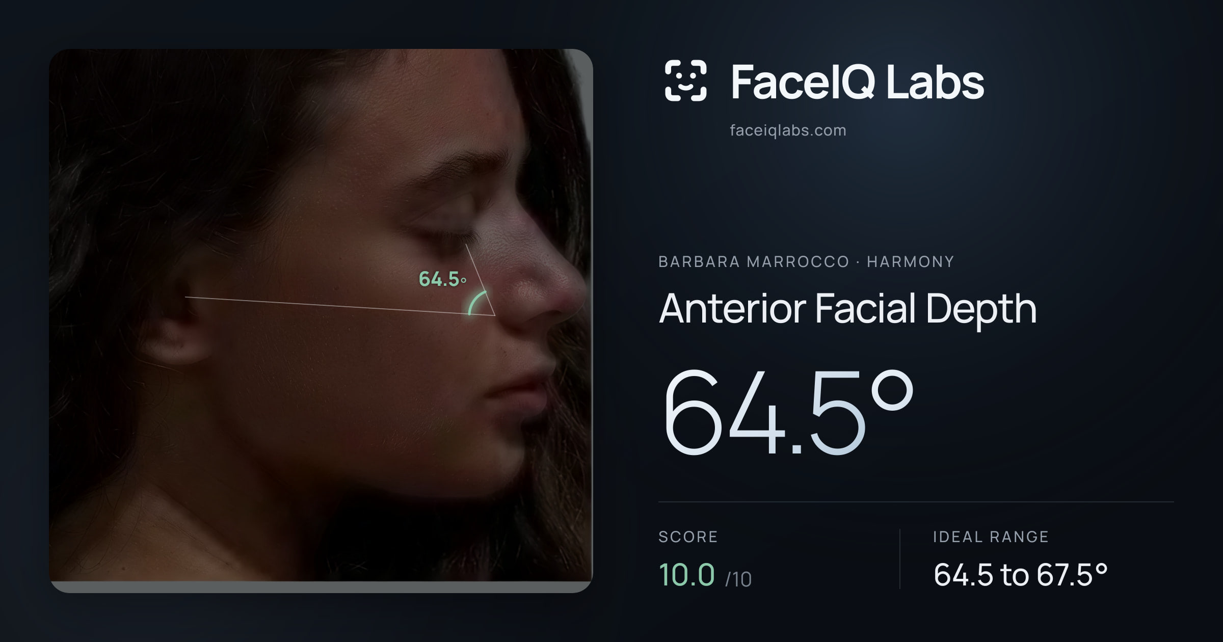 Barbara Marrocco Anterior Facial Depth: 64.5°, drawn on the photo