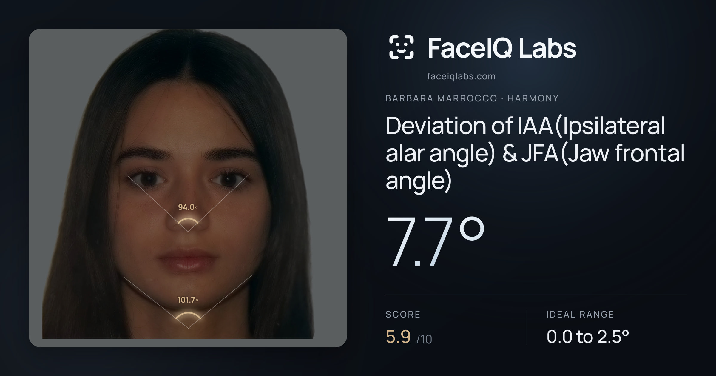 Barbara Marrocco Deviation of IAA(Ipsilateral alar angle) & JFA(Jaw frontal angle): 7.7°, drawn on the photo