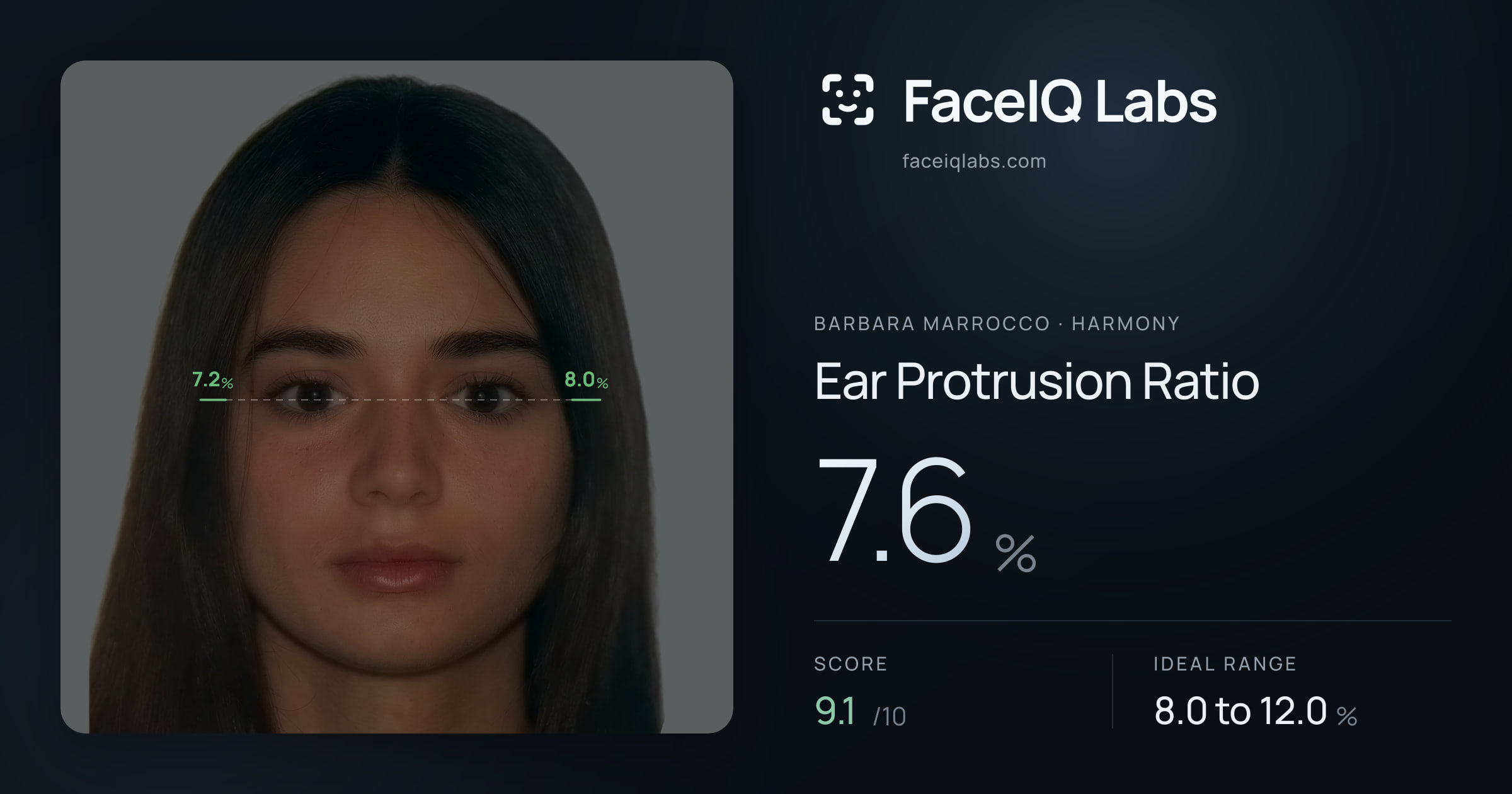 Barbara Marrocco Ear Protrusion Ratio: 7.6%, drawn on the photo