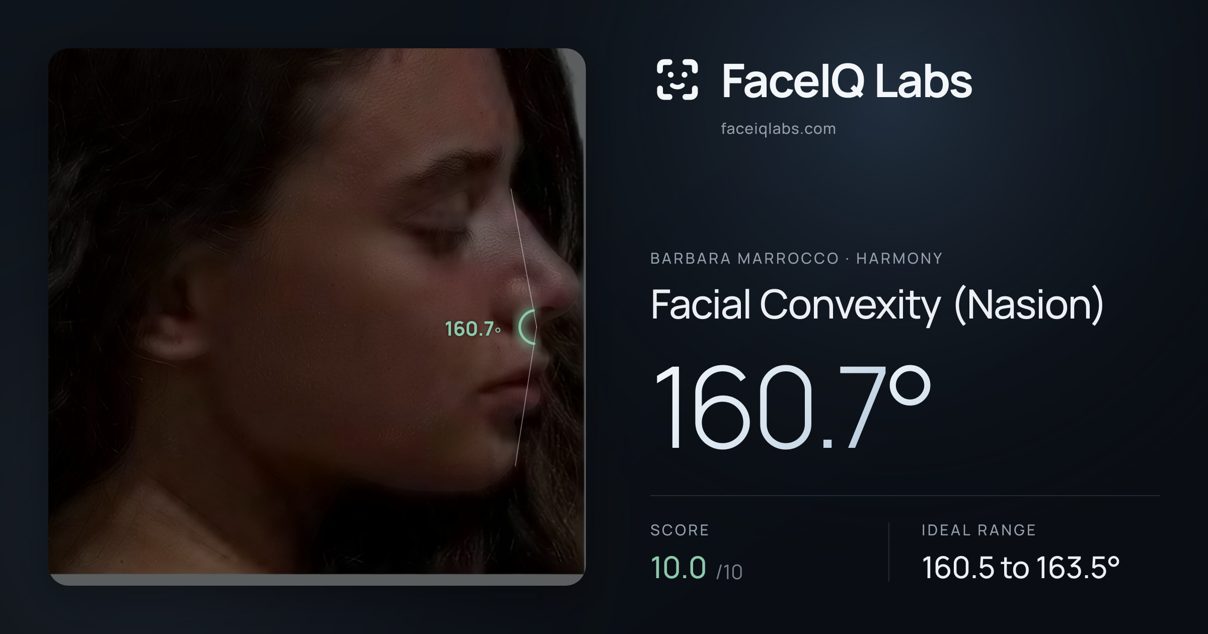 Barbara Marrocco Facial Convexity (Nasion): 160.7°, drawn on the photo