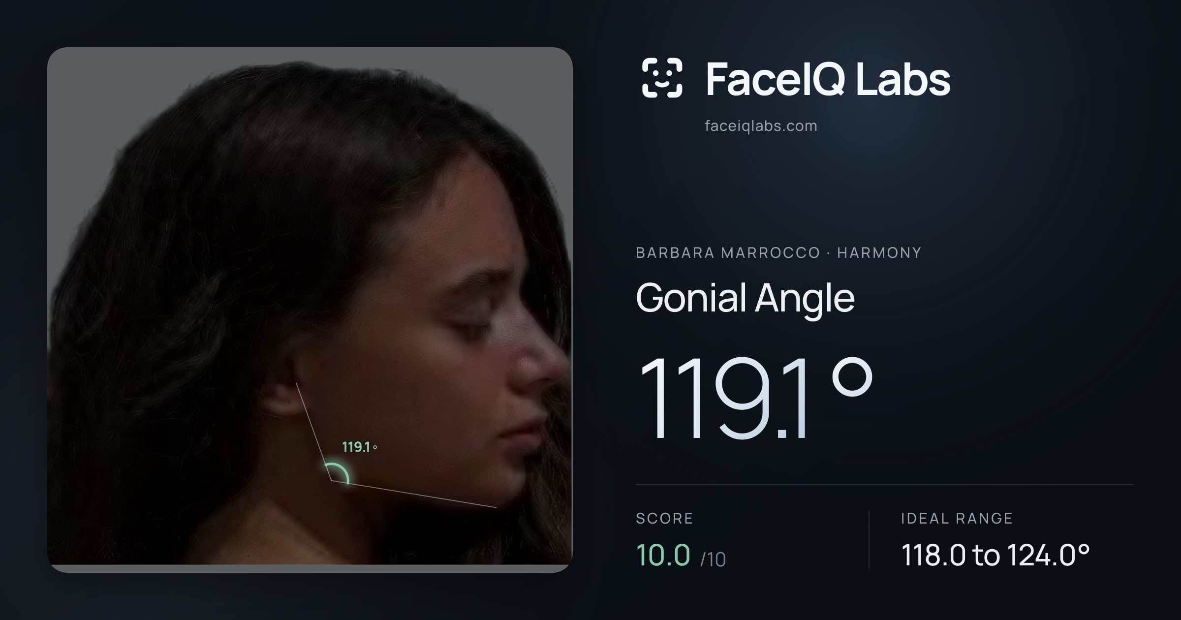 Barbara Marrocco Gonial Angle: 119.1°, drawn on the photo