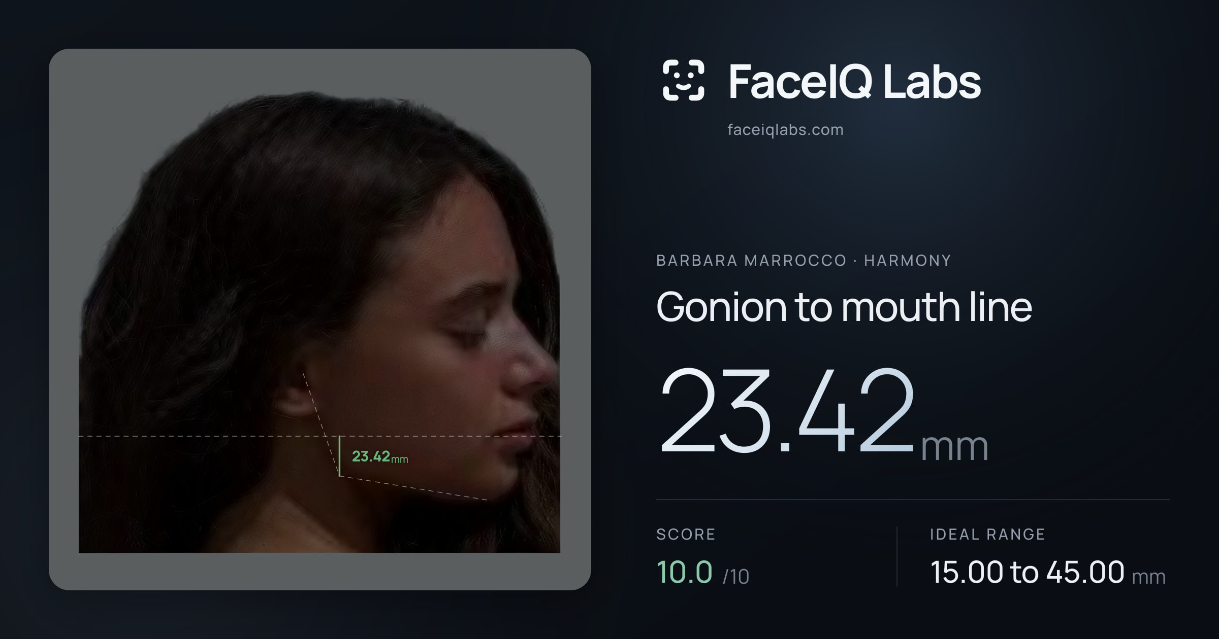 Barbara Marrocco Gonion to mouth line: 23.42mm, drawn on the photo