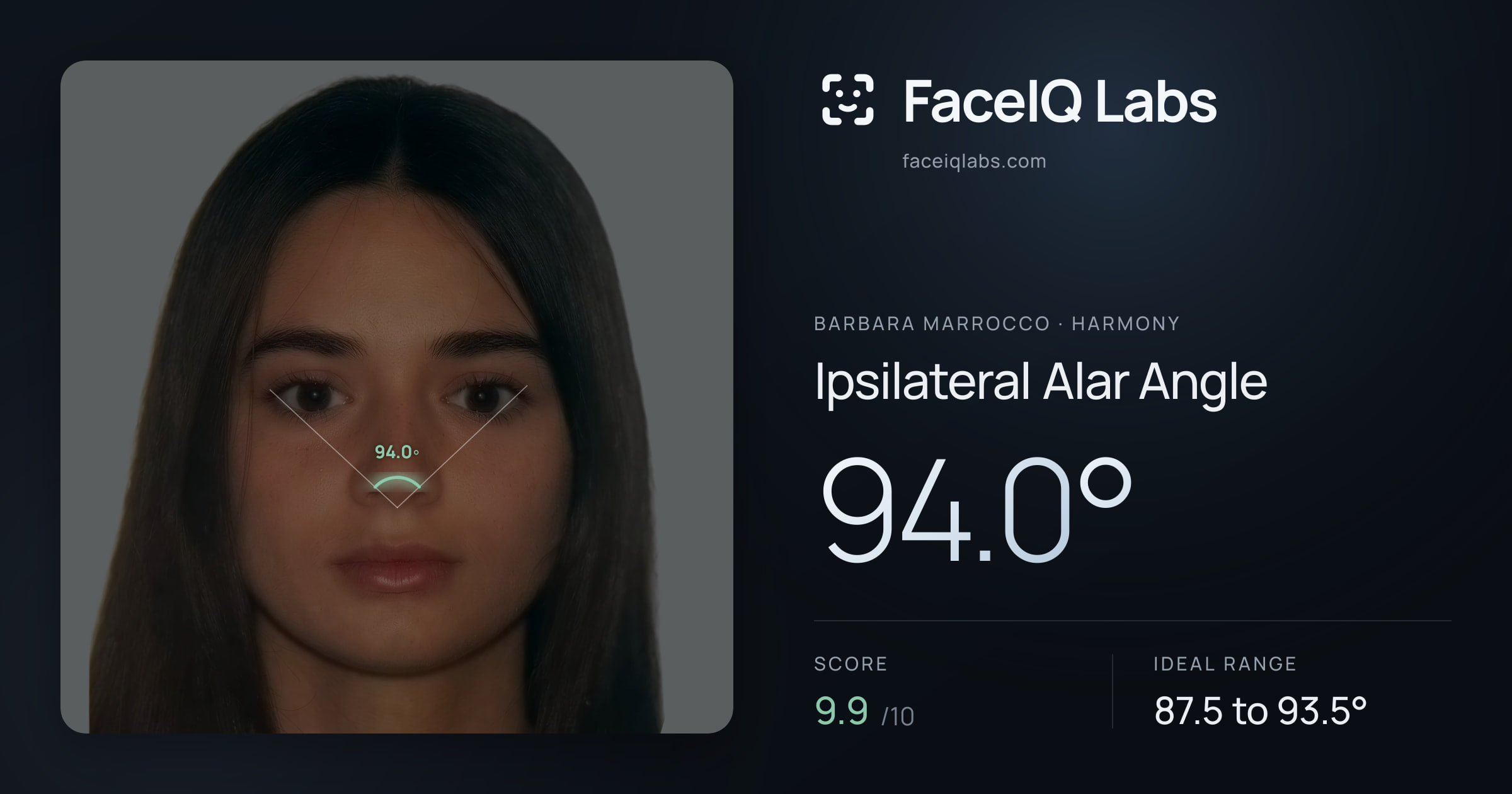 Barbara Marrocco Ipsilateral Alar Angle: 94.0°, drawn on the photo