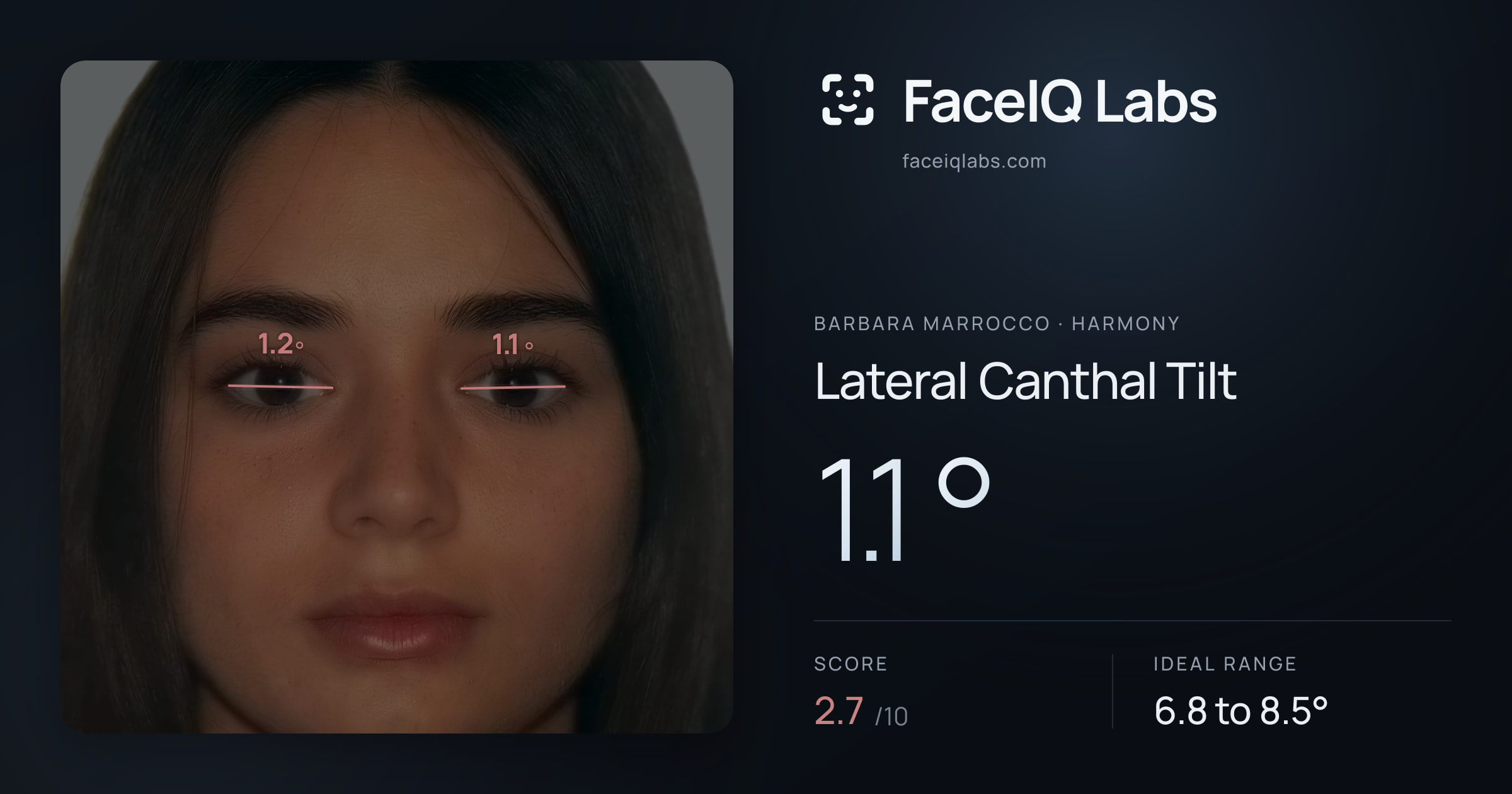 Barbara Marrocco Lateral Canthal Tilt: 1.1°, drawn on the photo