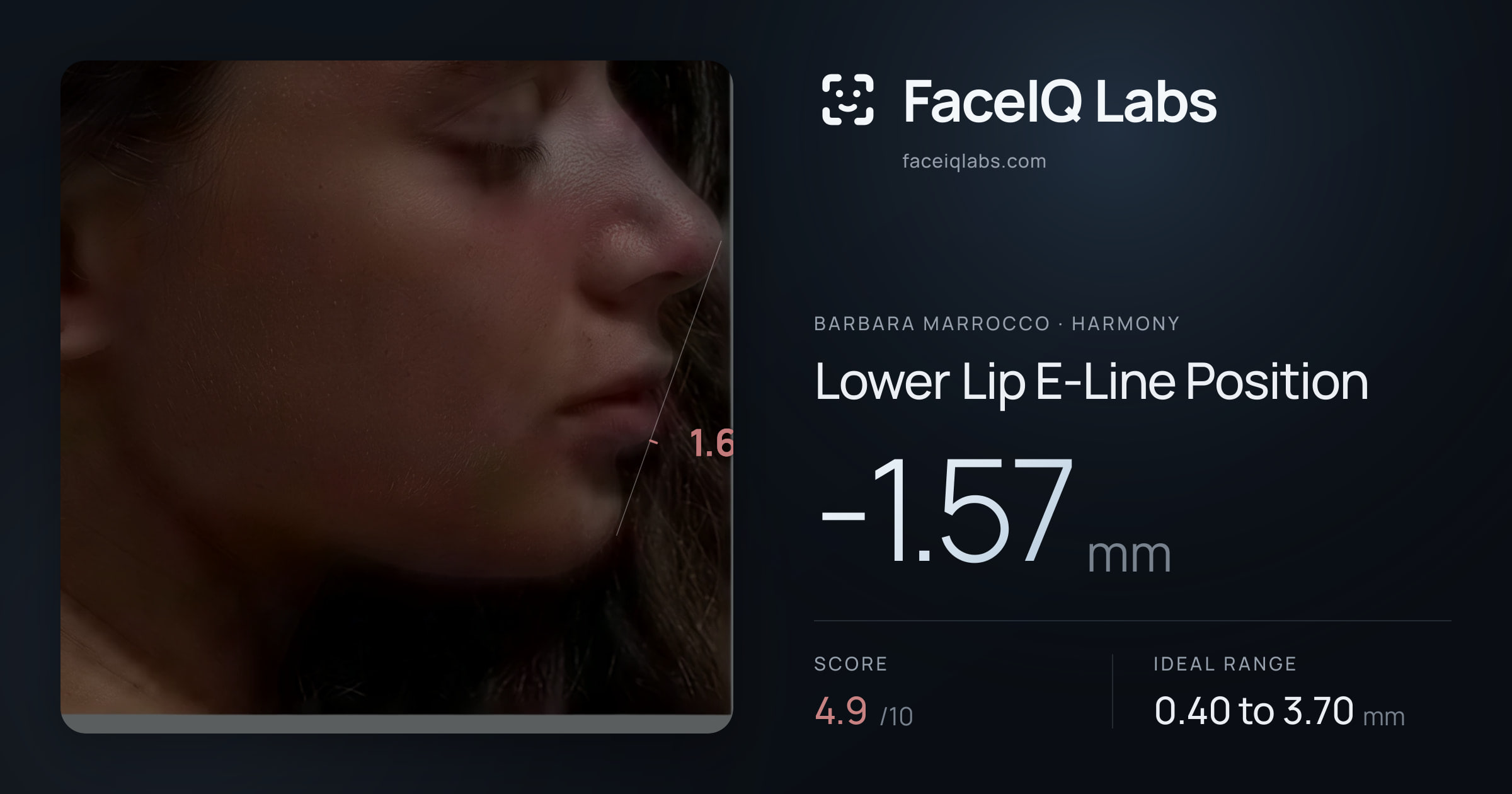 Barbara Marrocco Lower Lip E-Line Position: -1.57mm, drawn on the photo