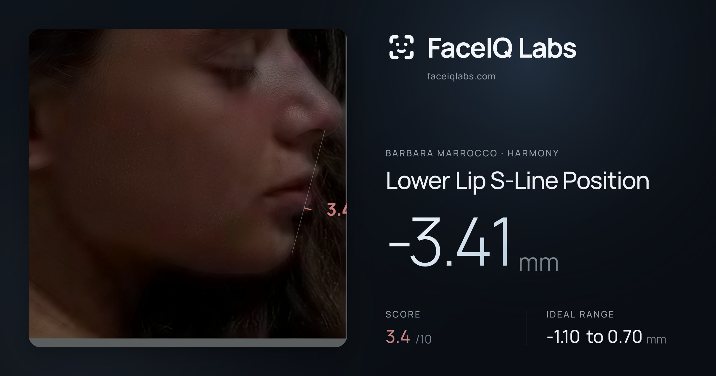 Barbara Marrocco Lower Lip S-Line Position: -3.41mm, drawn on the photo