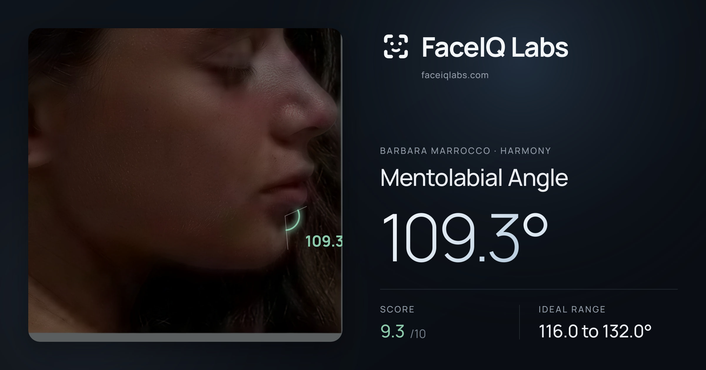 Barbara Marrocco Mentolabial Angle: 109.3°, drawn on the photo