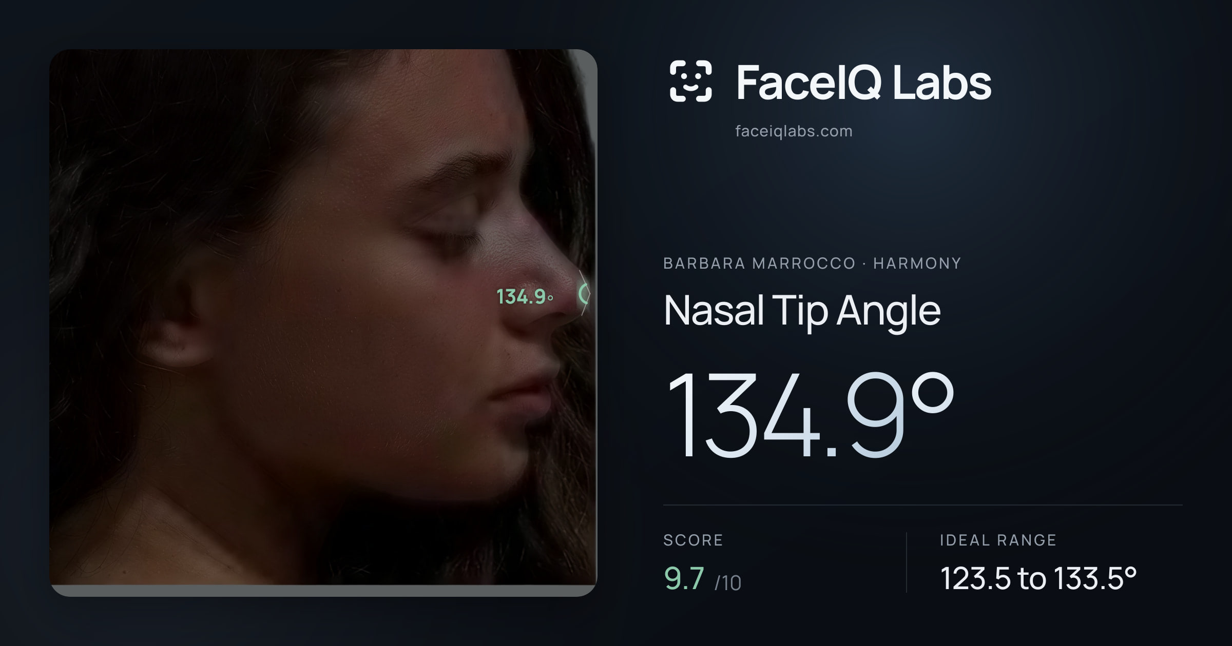 Barbara Marrocco Nasal Tip Angle: 134.9°, drawn on the photo