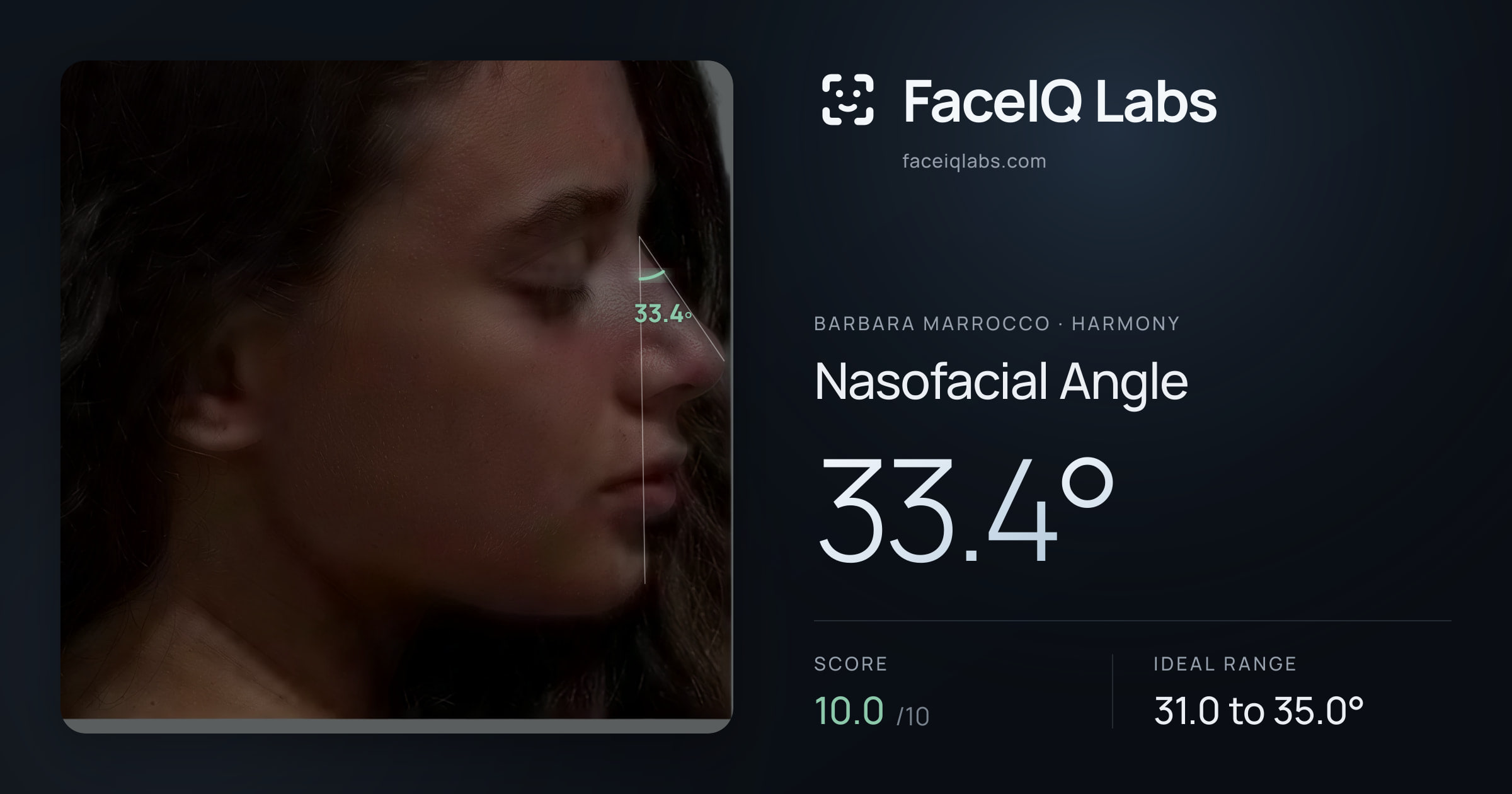 Barbara Marrocco Nasofacial Angle: 33.4°, drawn on the photo