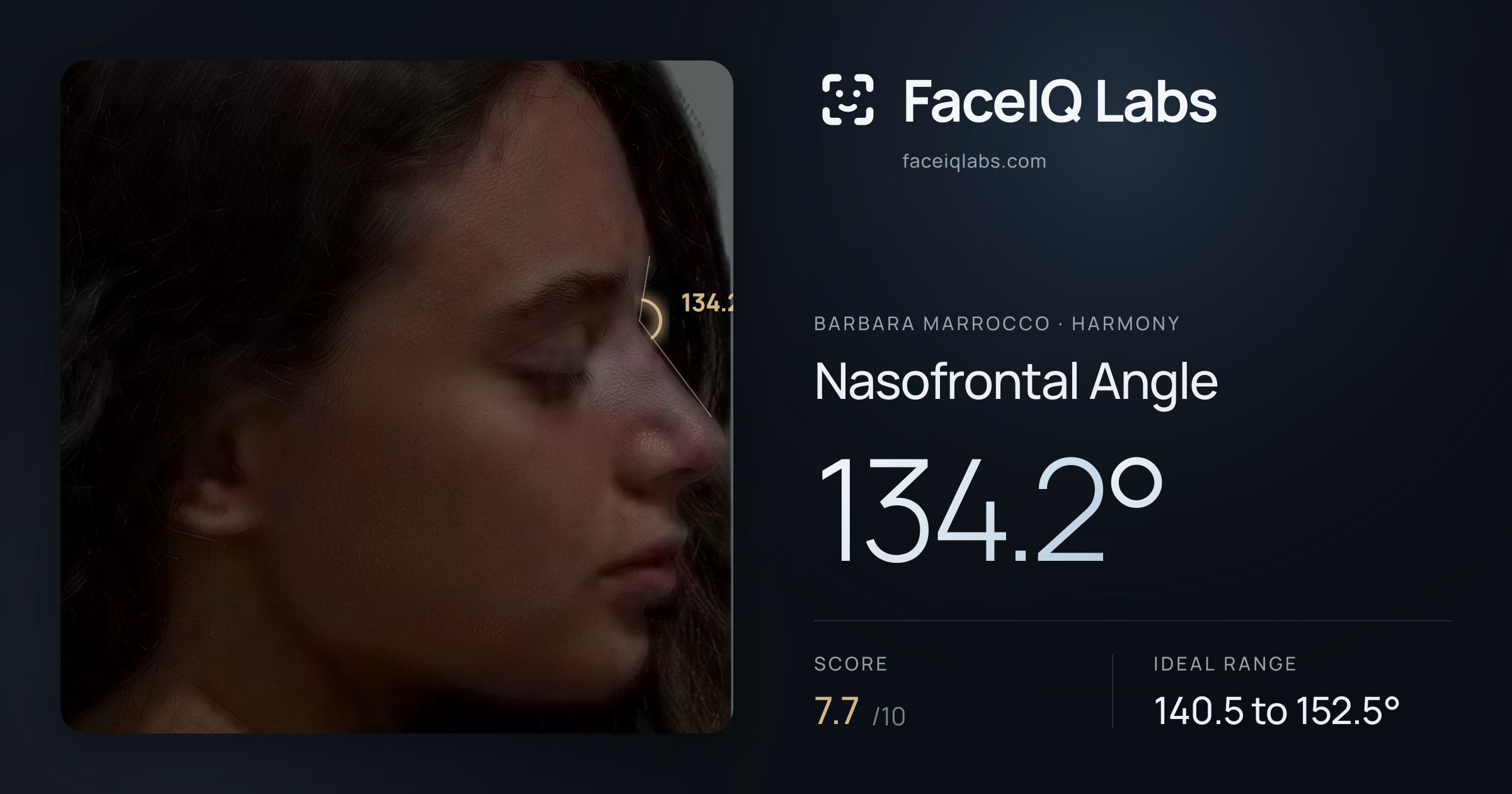 Barbara Marrocco Nasofrontal Angle: 134.2°, drawn on the photo