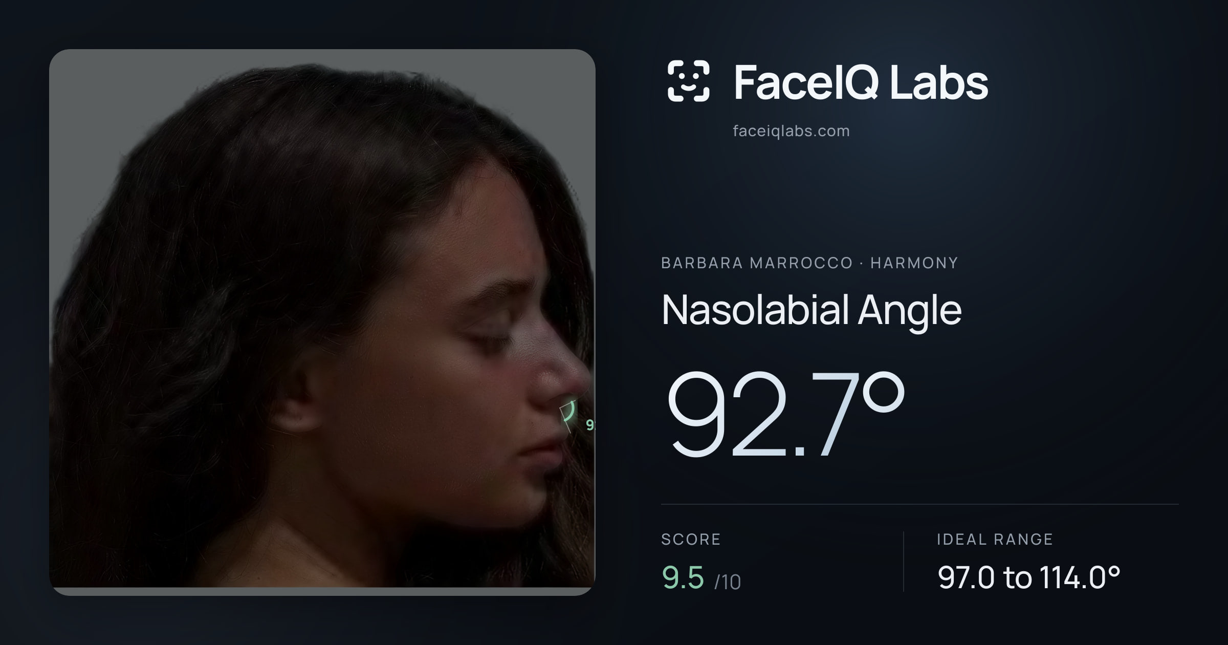 Barbara Marrocco Nasolabial Angle: 92.7°, drawn on the photo