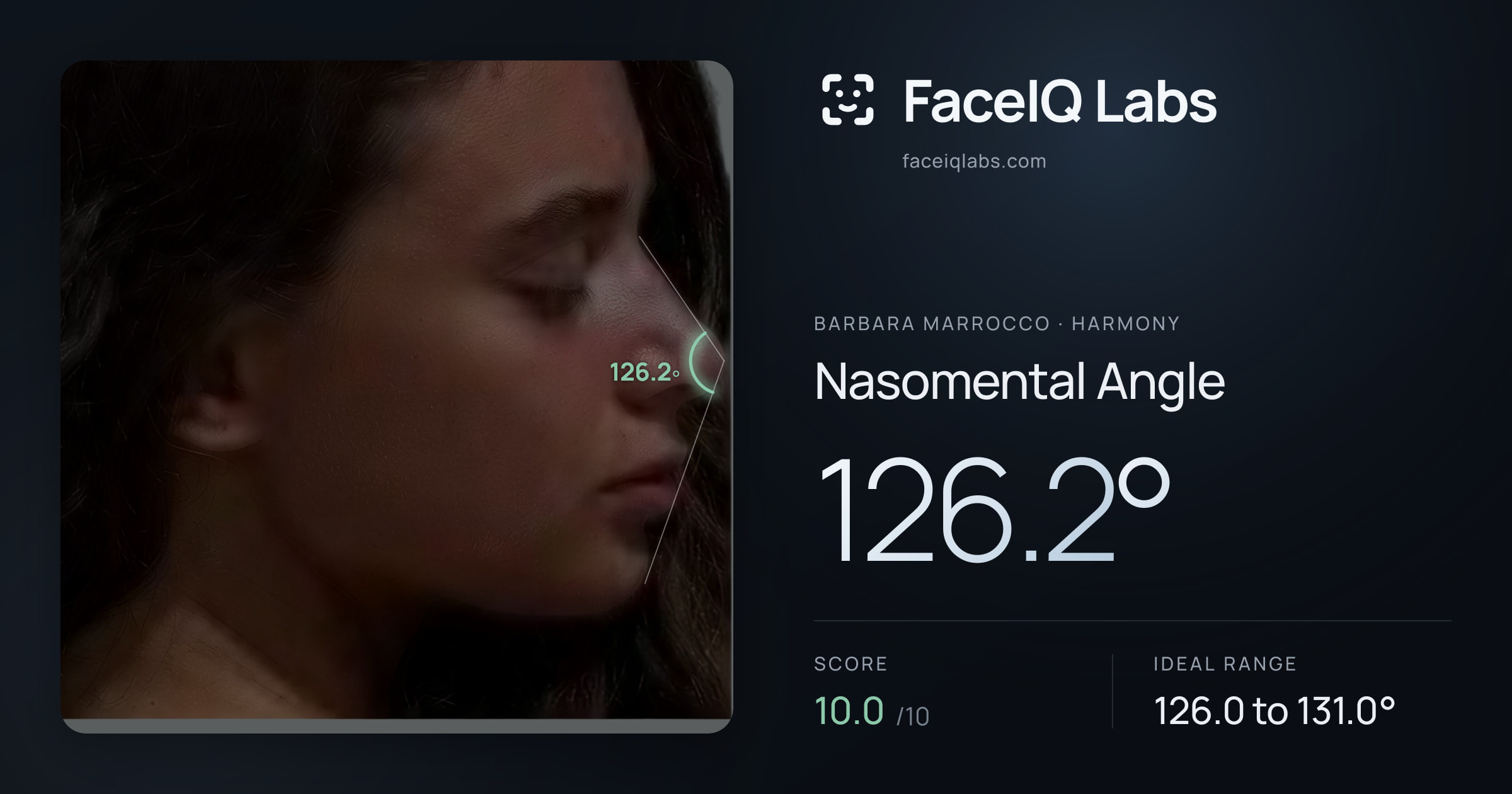 Barbara Marrocco Nasomental Angle: 126.2°, drawn on the photo
