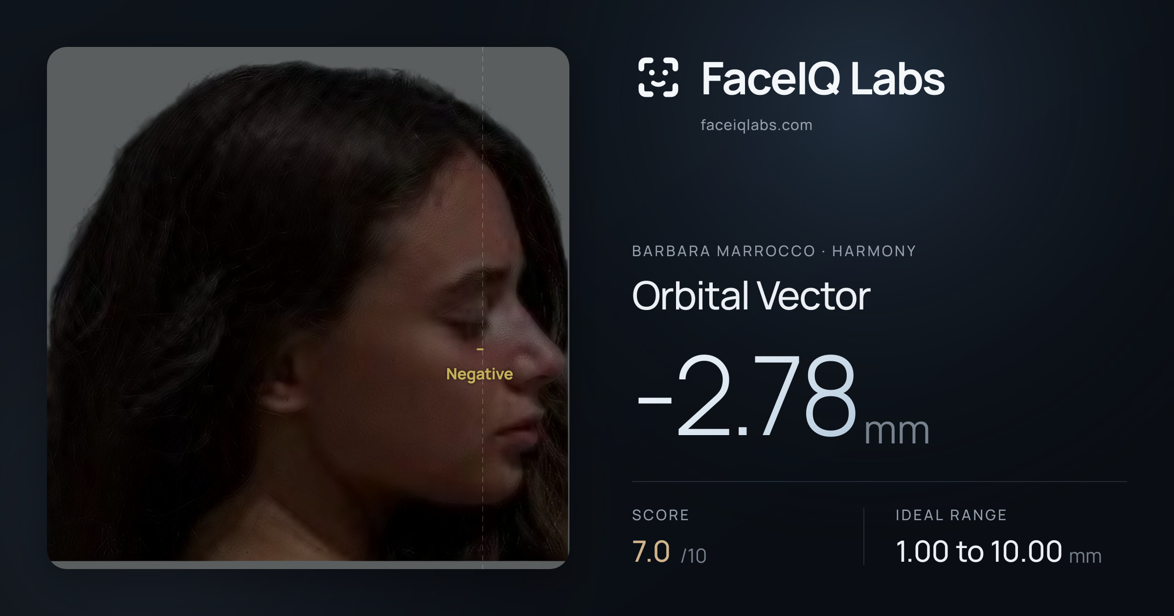 Barbara Marrocco Orbital Vector: -2.78mm, drawn on the photo