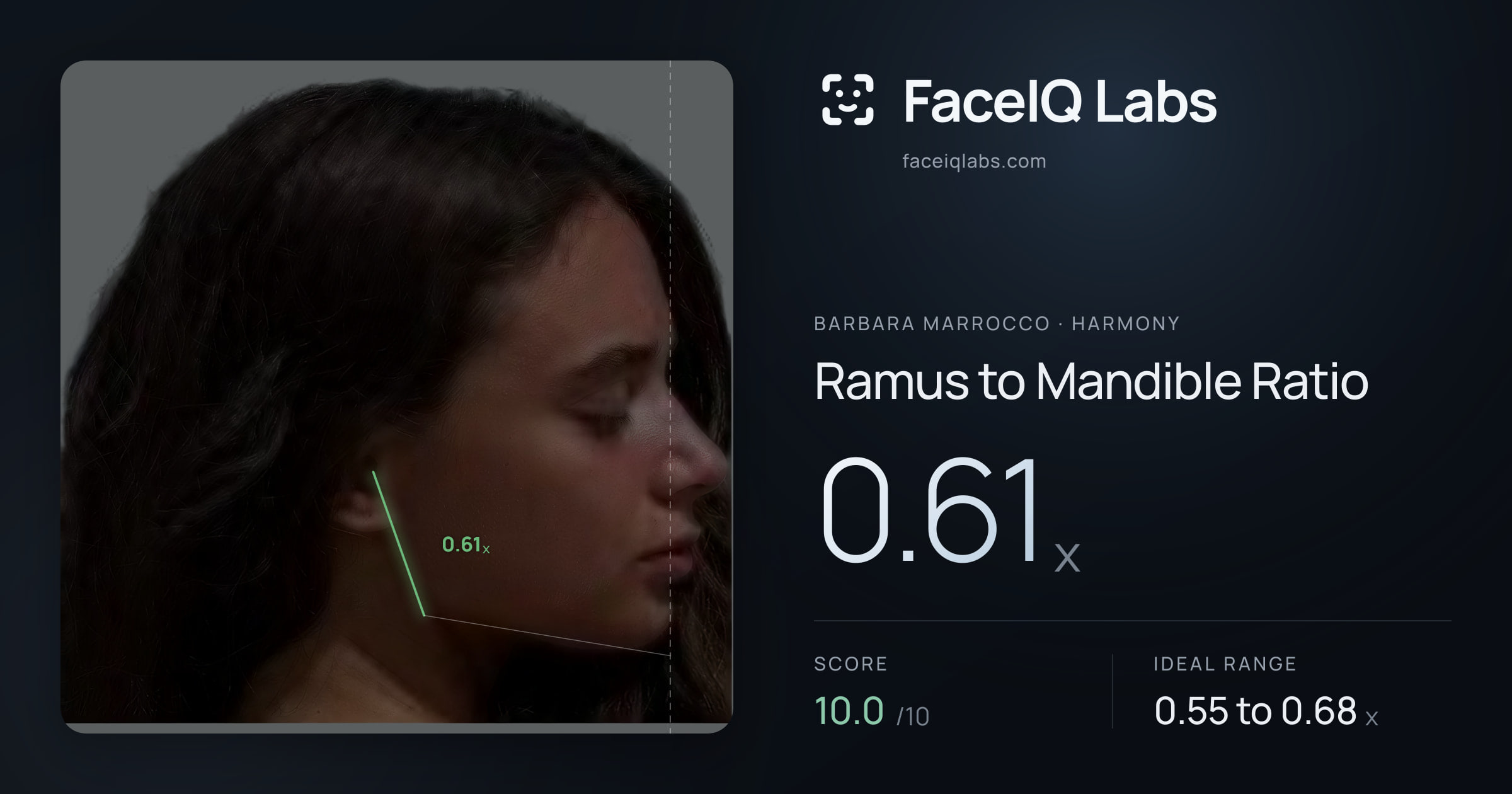 Barbara Marrocco Ramus to Mandible Ratio: 0.61x, drawn on the photo