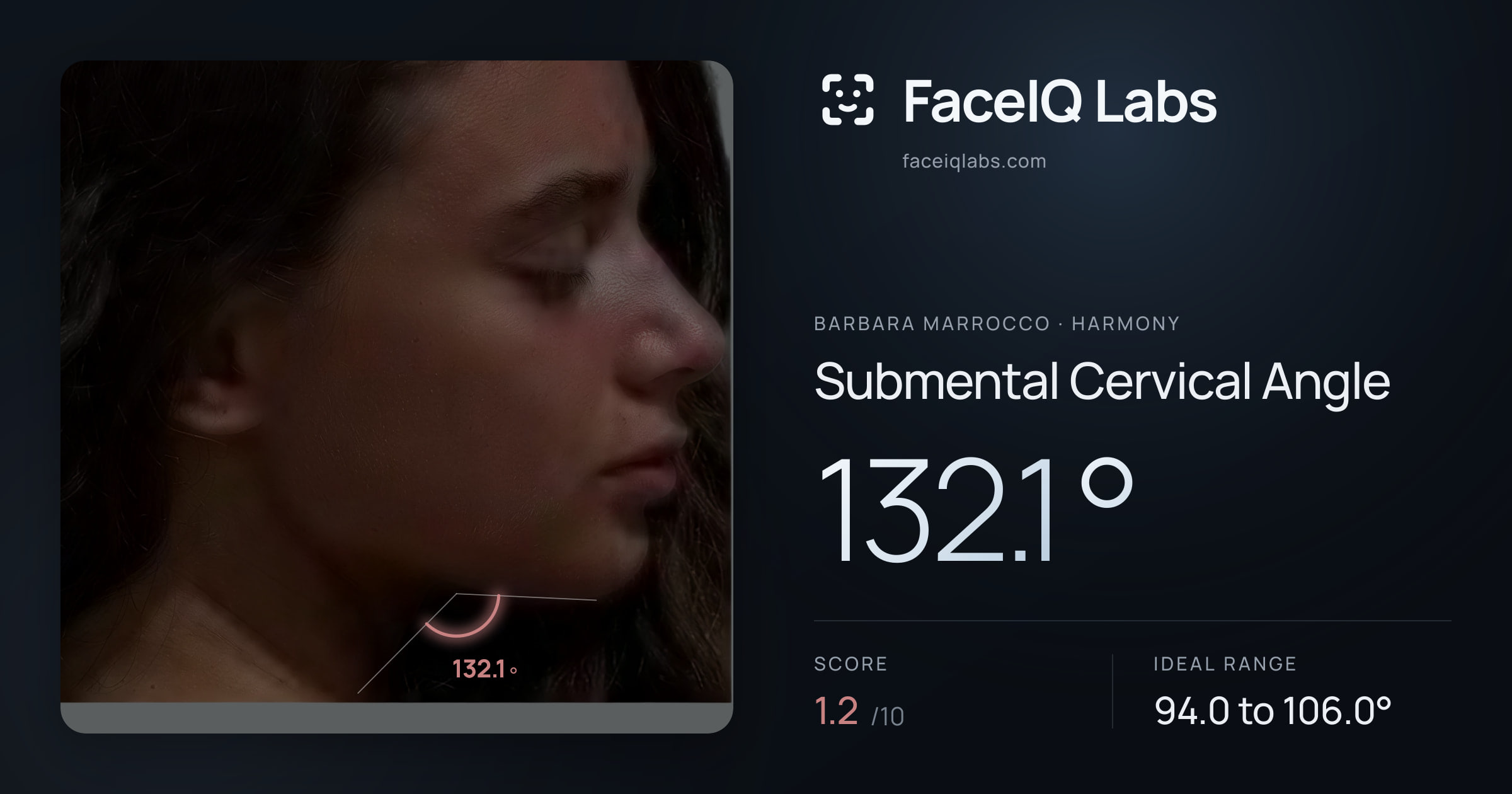 Barbara Marrocco Submental Cervical Angle: 132.1°, drawn on the photo