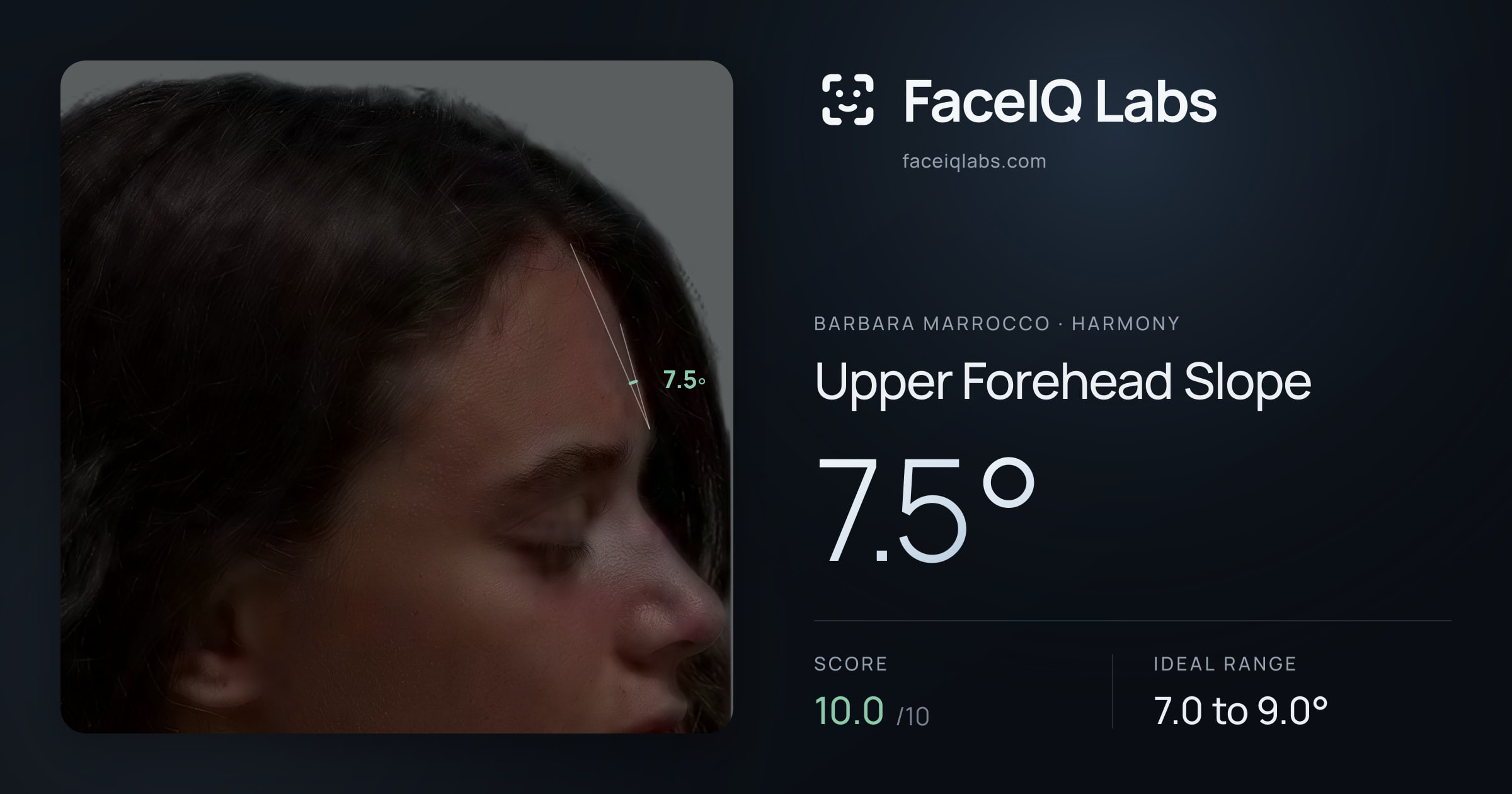 Barbara Marrocco Upper Forehead Slope: 7.5°, drawn on the photo