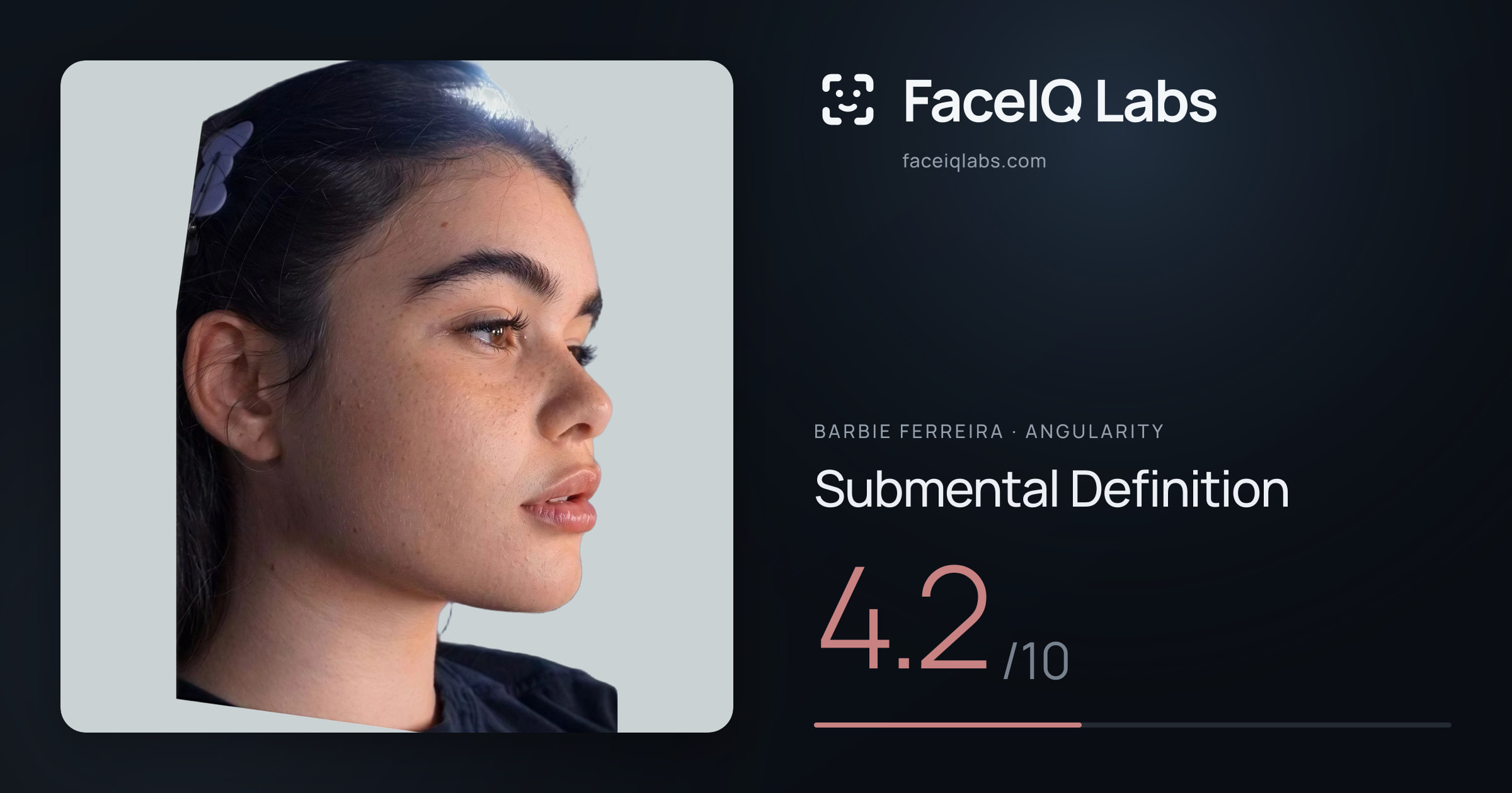 Barbie Ferreira Submental Definition: 4.2/10, drawn on the photo