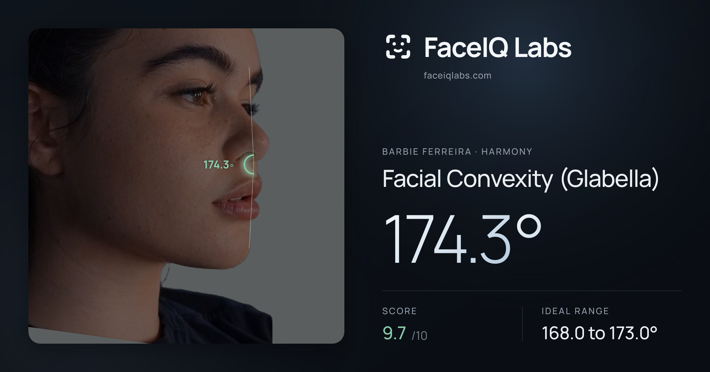 Barbie Ferreira Facial Convexity (Glabella): 174.3°, drawn on the photo