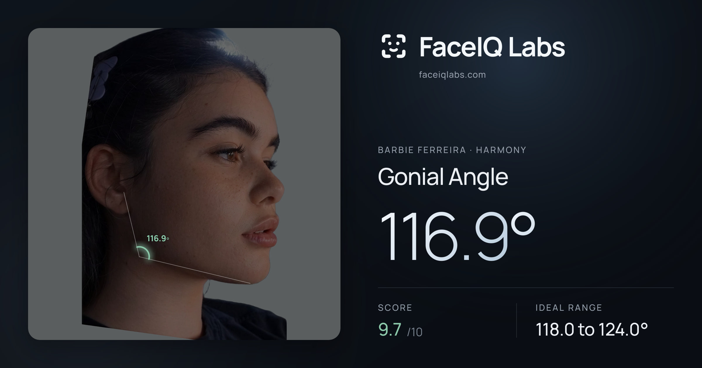 Barbie Ferreira Gonial Angle: 116.9°, drawn on the photo