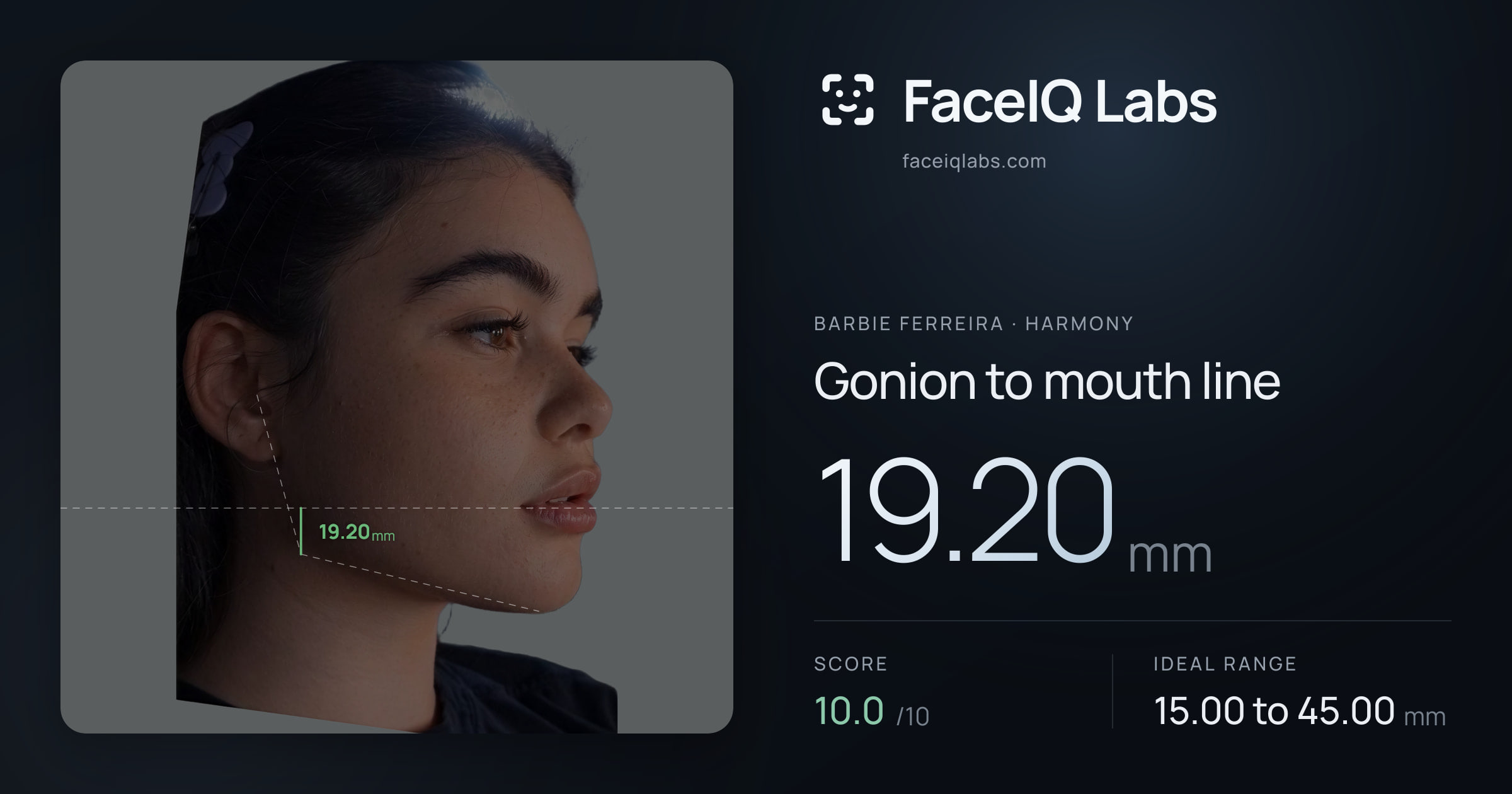 Barbie Ferreira Gonion to mouth line: 19.20mm, drawn on the photo